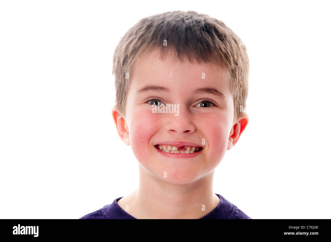 Ragazzo con mancante dente anteriore Foto Stock