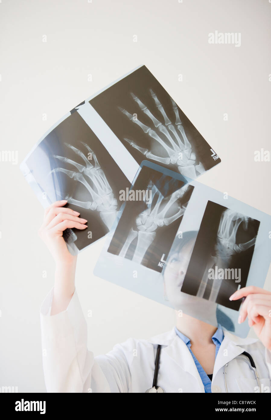 Il coreano medico guardando a raggi x di ossa a mano Foto Stock