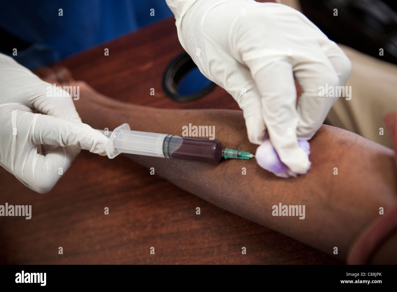 Un infermiere aspira il sangue da un HIV positiva paziente presso una clinica supportata da Catholic Relief Services a Kitwe, Zambia. Foto Stock