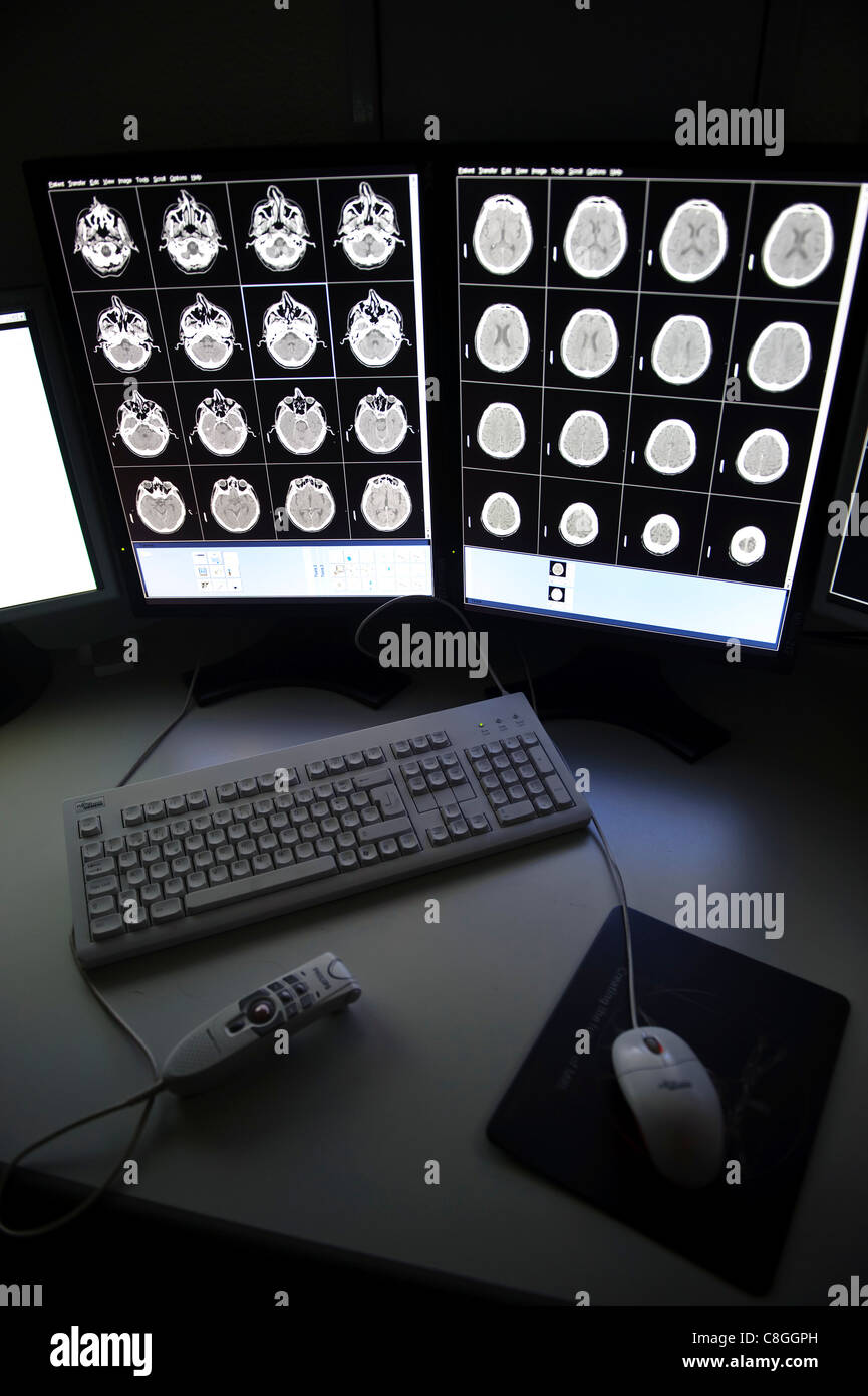 CT Brain scan su schermi di computer Foto Stock