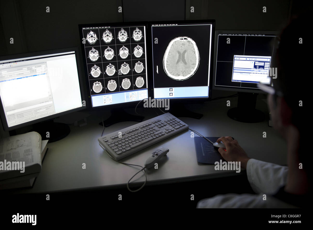 Medico esame CT Brain scansione al computer Foto Stock