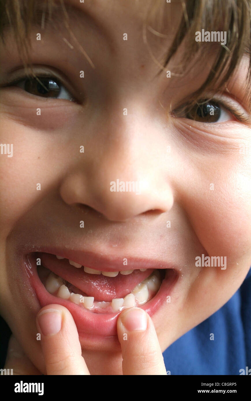 Bambino, ragazzo, denti milkteeth, dentale gap, nuovamente, dente Foto Stock