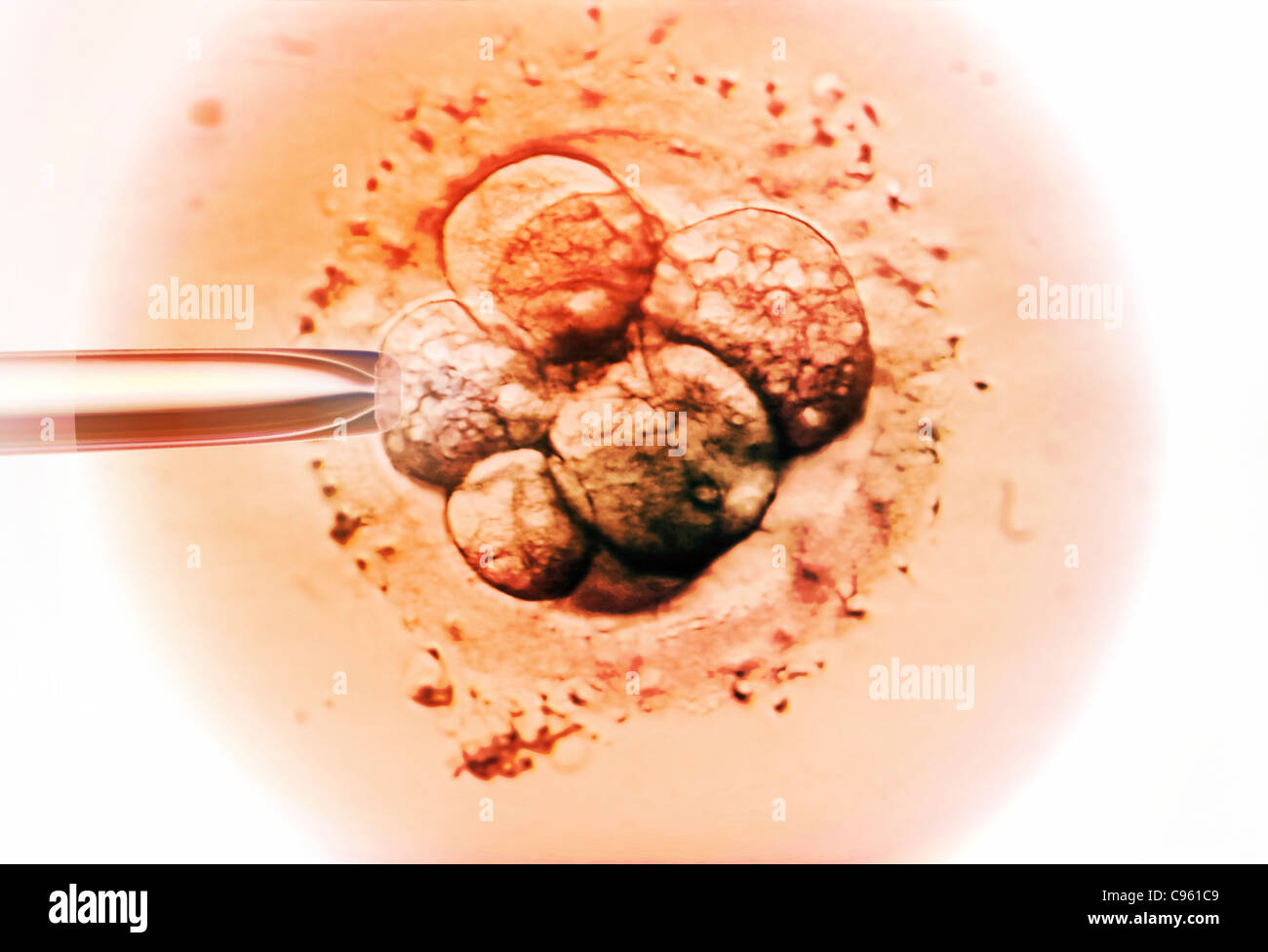 La selezione di embrioni per la fecondazione in vitro (IVF) Micrografia di luce. Foto Stock