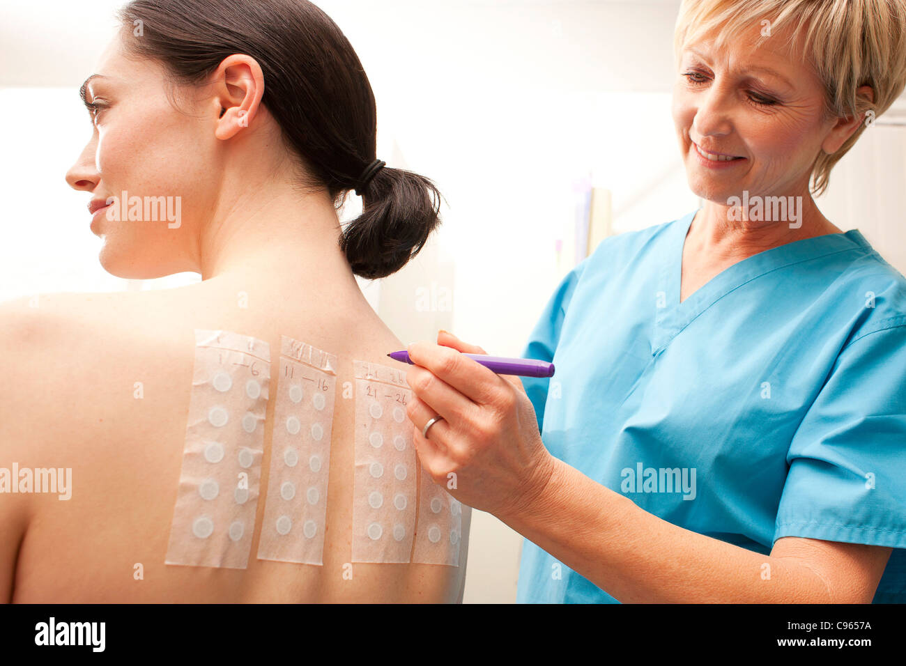 Allergia patch test. Foto Stock