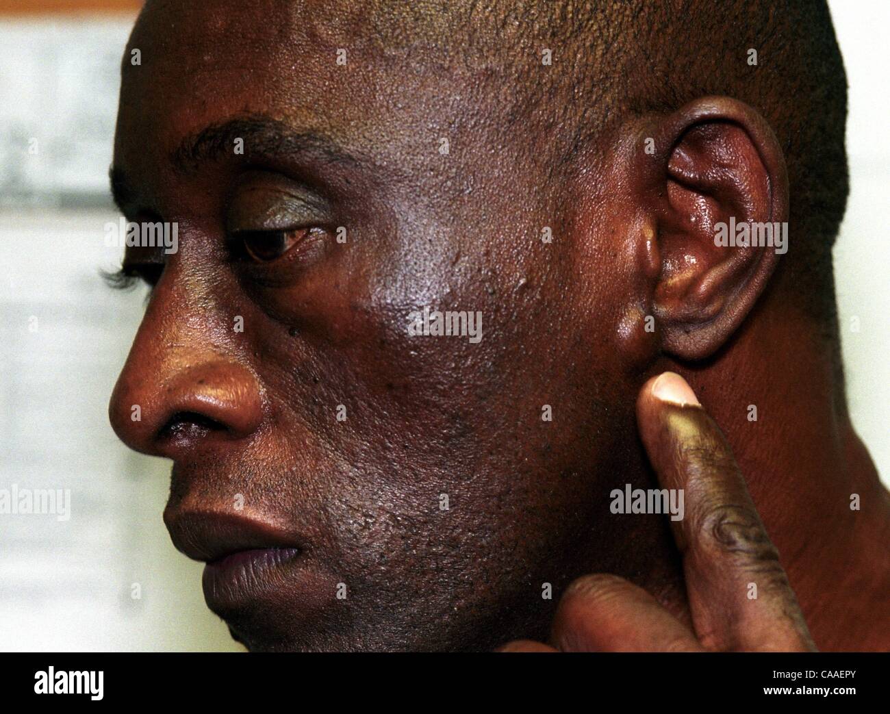 Mar 15, 2003 - Huntsville, AL, USA - ogni uomo in Alabama sistema carcerario noto per avere l AIDS è confinata a un convertito vecchio magazzino con alta, leaky soffitti e letti a castello così vicini che favoriscono l'infezione tra affetti da AIDS, condannati a calcare correzionali Facility. Più th Foto Stock