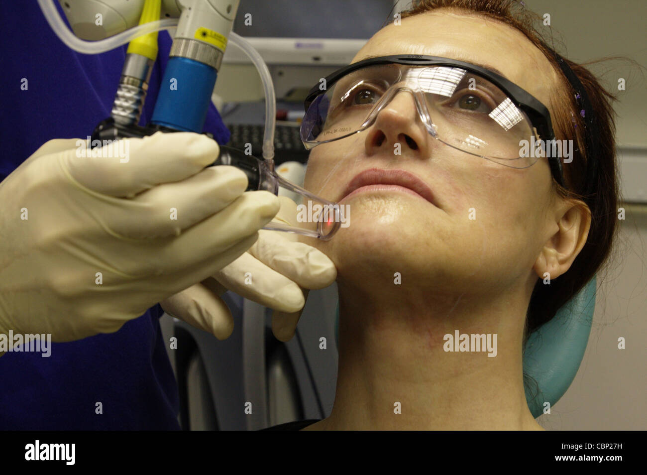 Un medico esegue ipl laser chirurgia estetica per un viso femminile Foto Stock