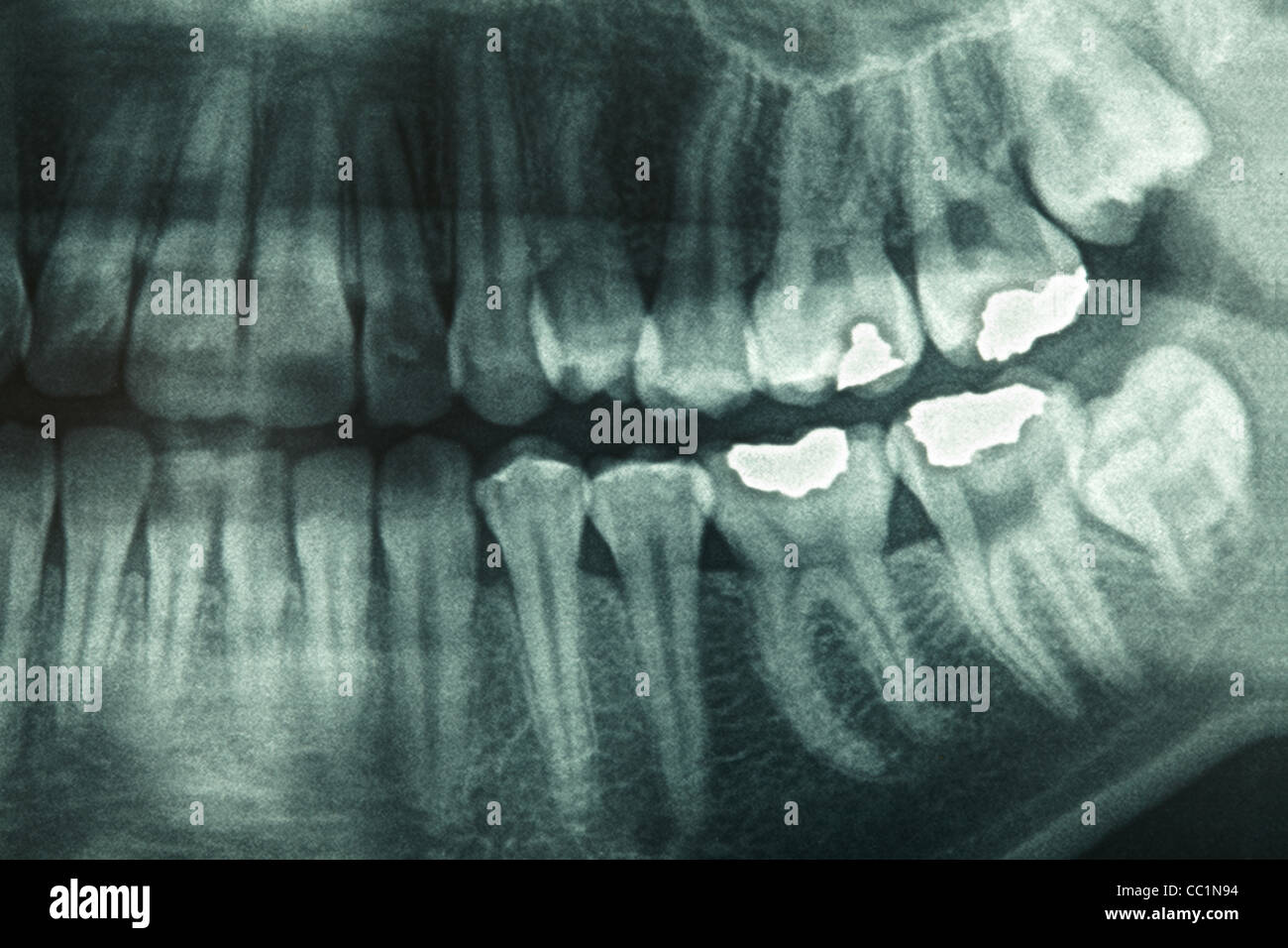 1000 Buste Barriera Digitali A Raggi X Dentali Taglia 2 Per Piastre Al - Foto 4
