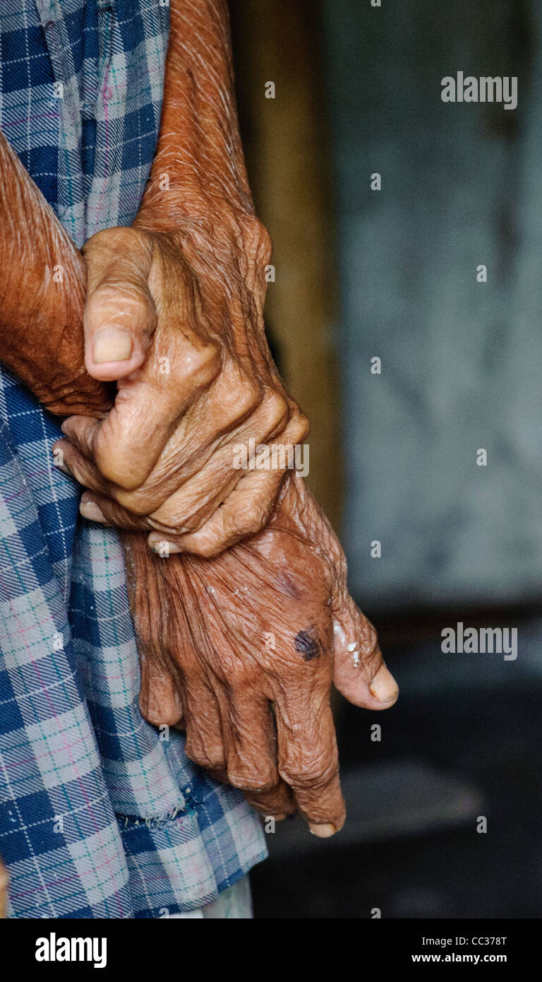 Mano di artritici 92 anno vecchia donna in Honduras Foto Stock