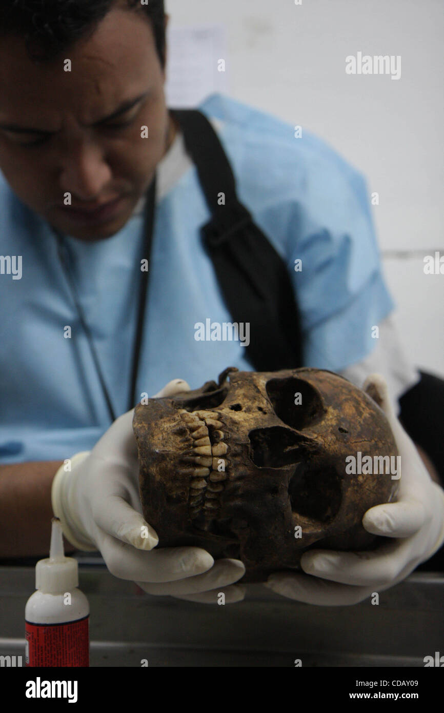Settembre 17, 2010 - Città del Guatemala, Guatemala - ossa con segni di trauma sono oggetto di un trattamento speciale, come studi preliminari hanno determinato che la maggior parte delle vittime di scomparsa forzata che sono stati infine sepolto come XX in La verbena erano probabilmente eseguito per primo. Quindi, ogni volta che un osso mostra un trauma si Foto Stock