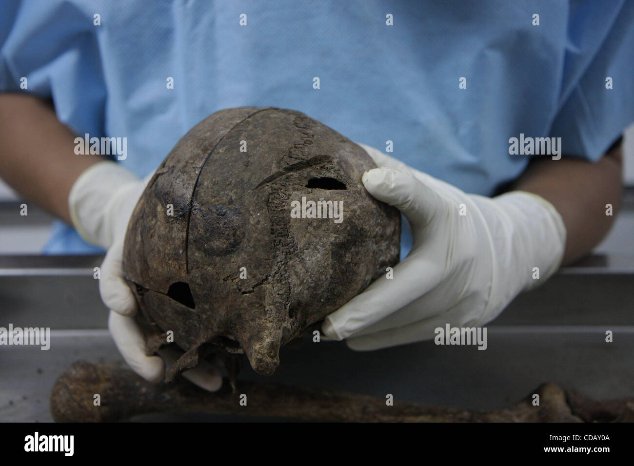 Settembre 17, 2010 - Città del Guatemala, Guatemala - questo cranio visualizza clear trauma che è stato probabilmente causato da un machete, ax, o analogamente strumento affilato. Le ossa con segni di trauma sono oggetto di un trattamento speciale, come studi preliminari hanno determinato che la maggior parte delle vittime di scomparsa forzata che erano Foto Stock