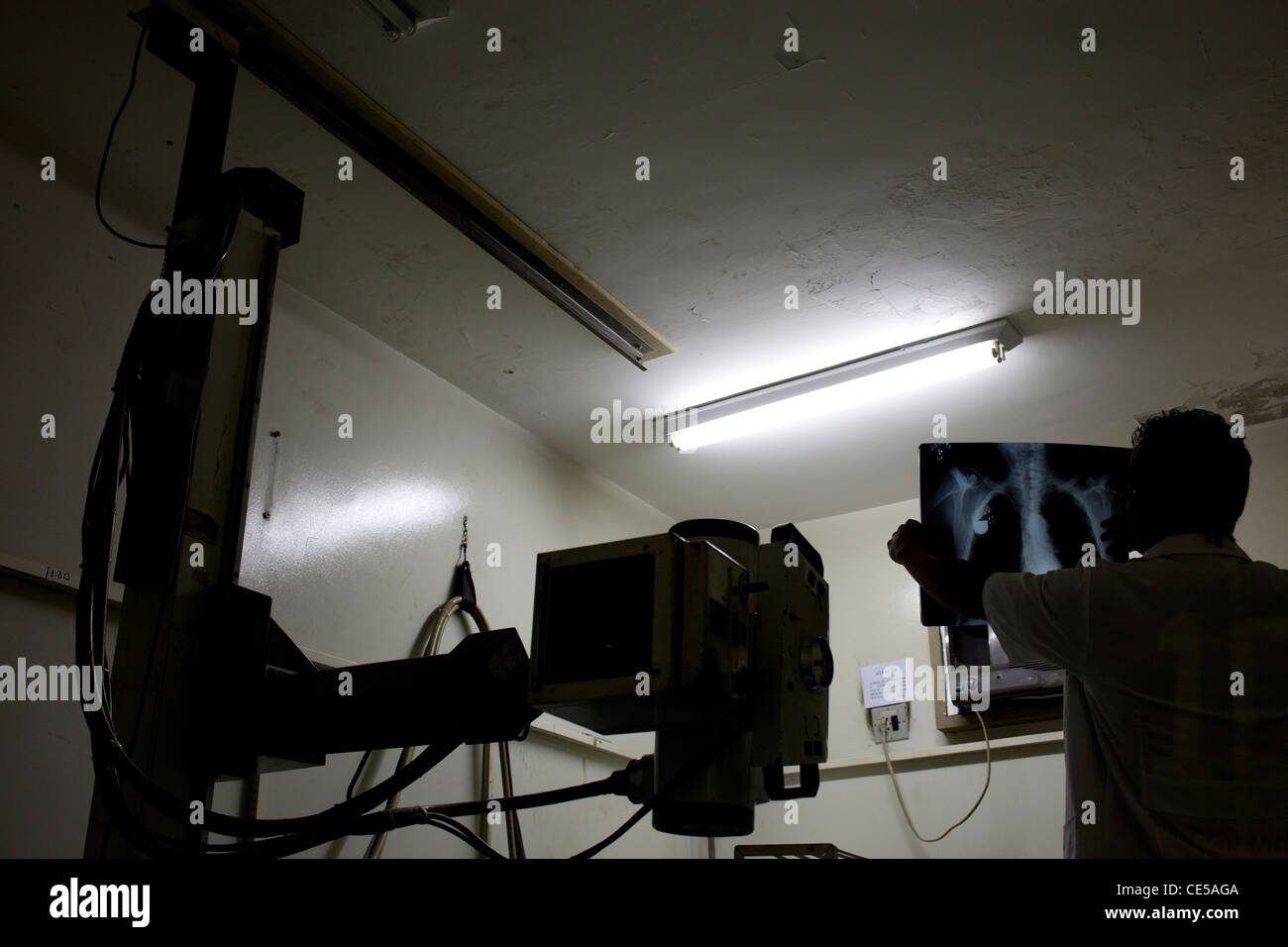 Polmone X-ray exam Mesquita comune la tubercolosi programma di controllo, Stato di Rio de Janeiro, Brasile Foto Stock