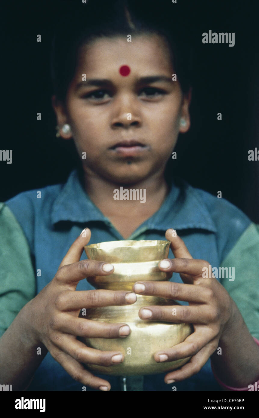 Hexadactilly ; ragazza indiana con sei dita in mano ; malformazione congenita ; Polidattilia ; polidattilismo ; iperdattilia ; India ; Asia Foto Stock