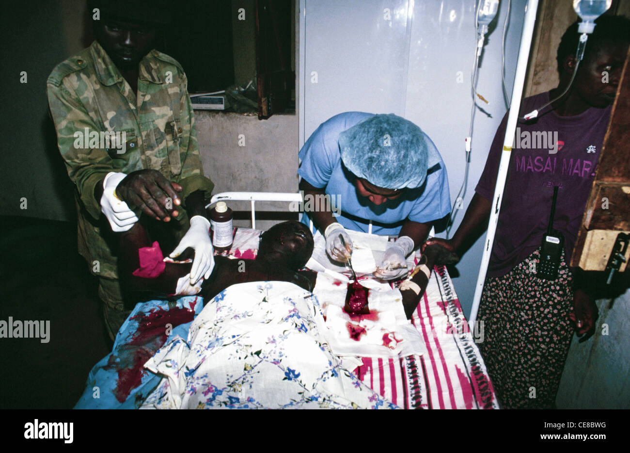 Soldato SPLA gravemente ferito che ha estratto dal suo braccio shrapnel sud Sudan, Africa, senza anestetico Foto Stock