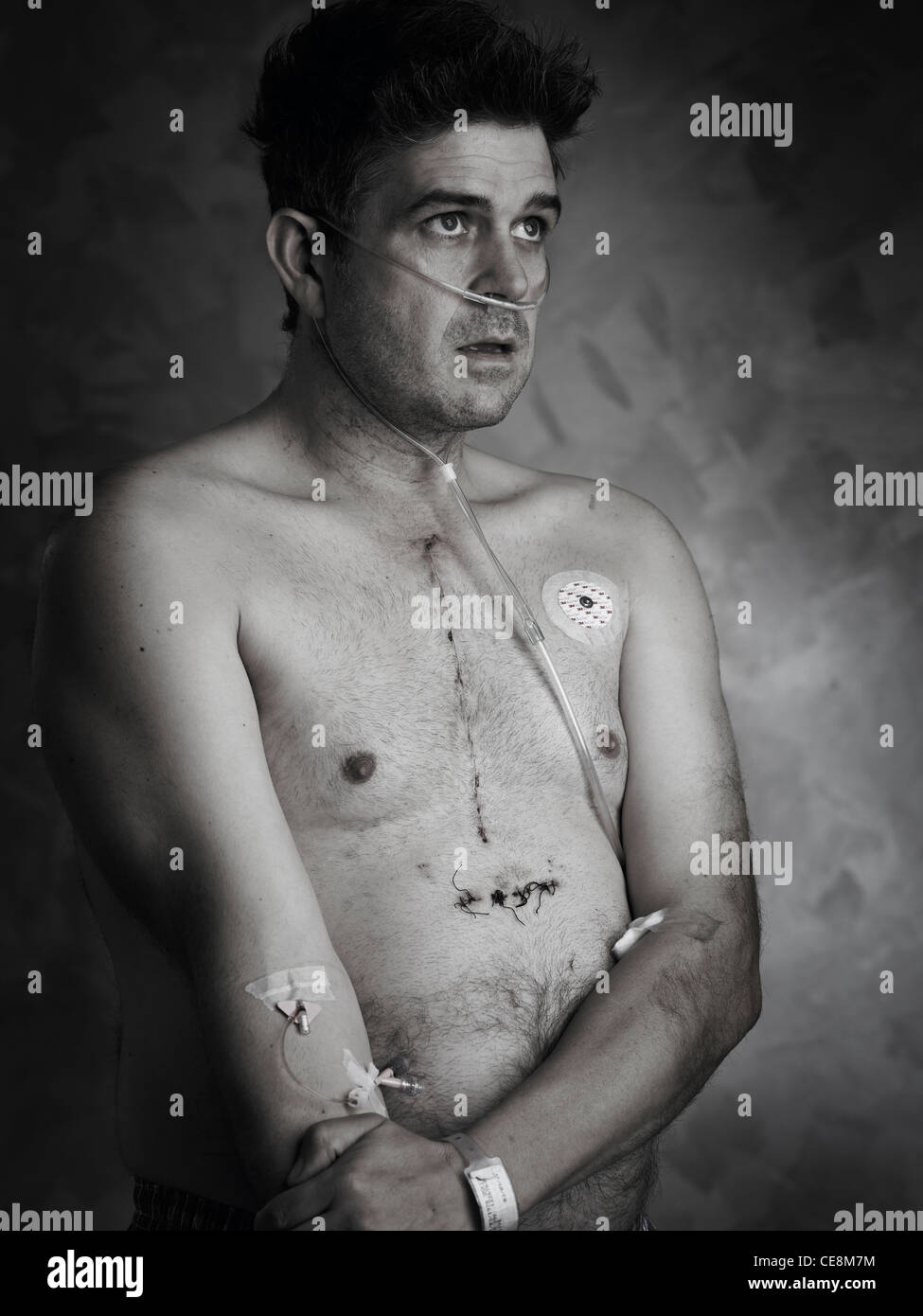 L'uomo recuperando da operazione cuore cabg byepass Foto Stock