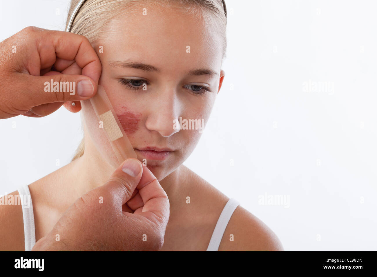 Applicare mani di bendaggio adesivo sulla ragazza (12-13) faccia Foto Stock