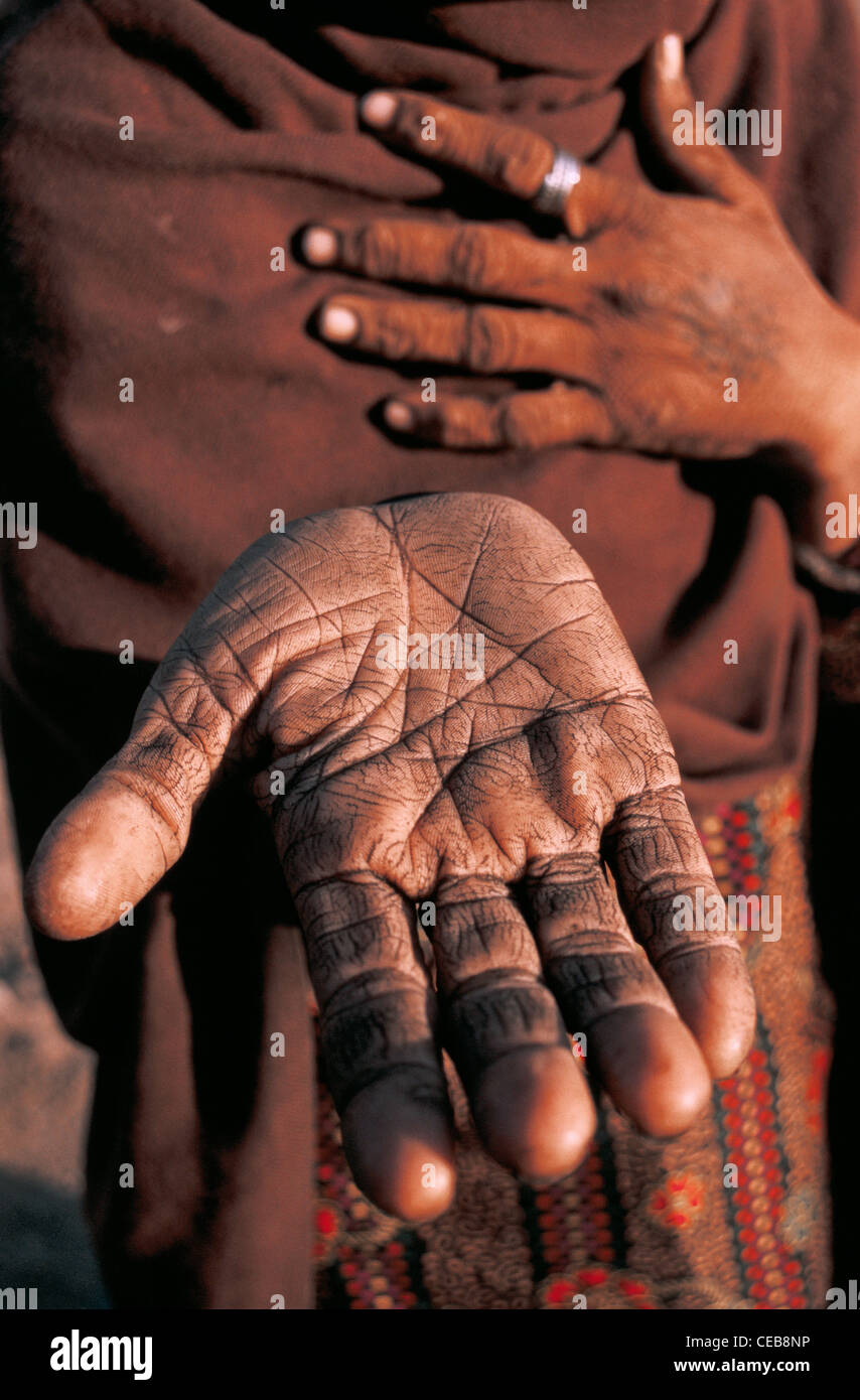 Molto povera donna che mostra la sua mano ( India) Foto Stock