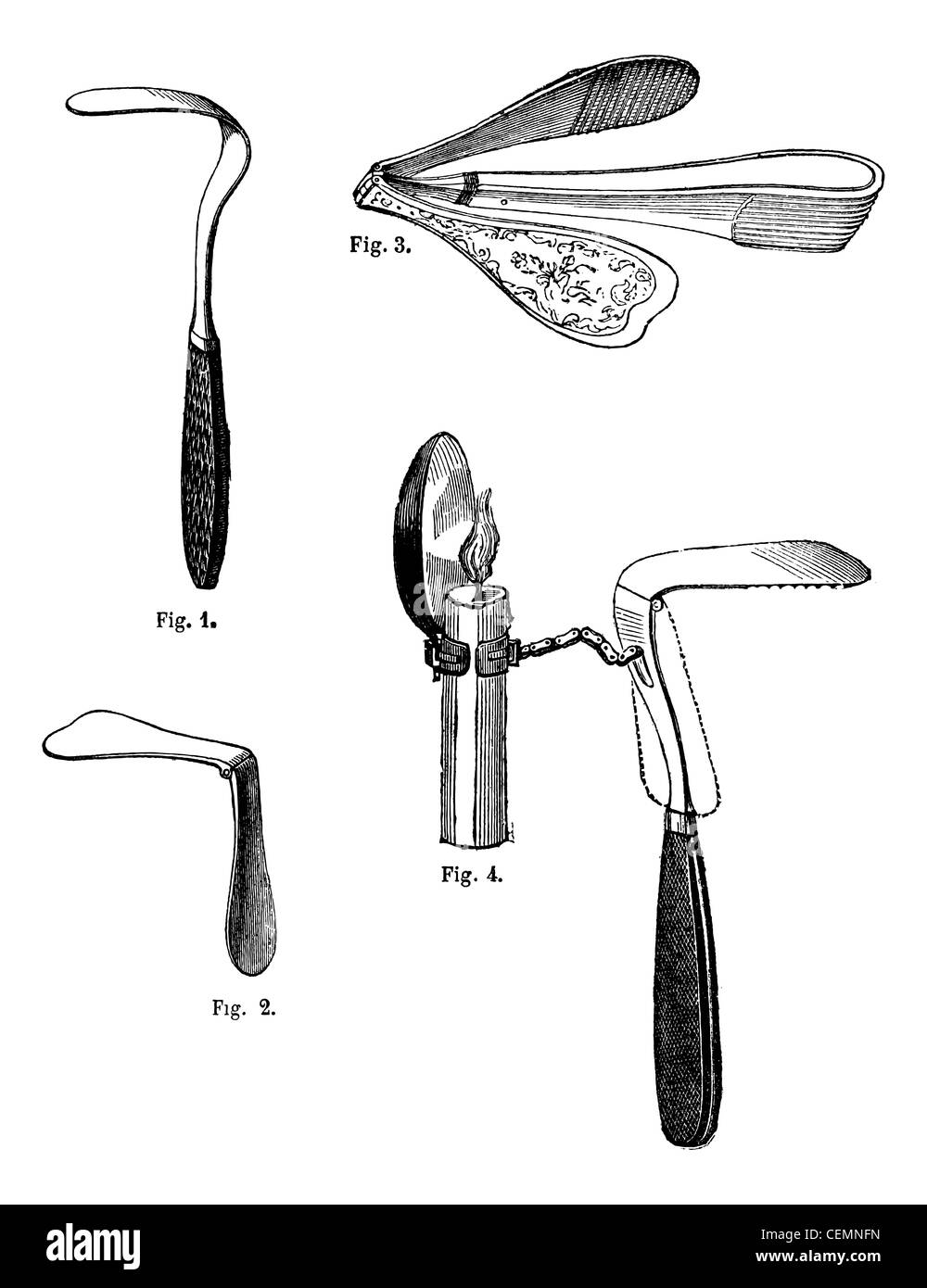 Figura 1. abbassa lingua fissata, fig.2 abbassa lingua si articola, fig 3. abbassa lingua articolare, ricord, fig 4. abbassa lingua si articola con riflettore, vintage illustrazioni incise. magasin pittoresco 1875. Foto Stock