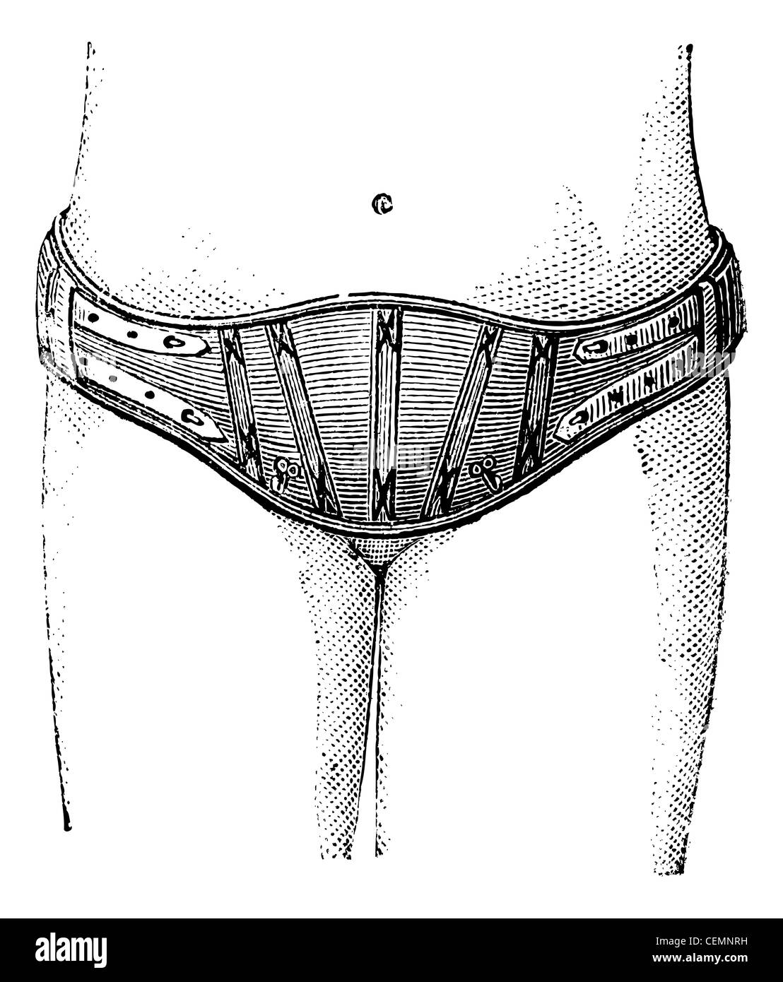 Cinghia Hypogastric, vintage illustrazioni incise. Magasin pittoresco 1875. Foto Stock