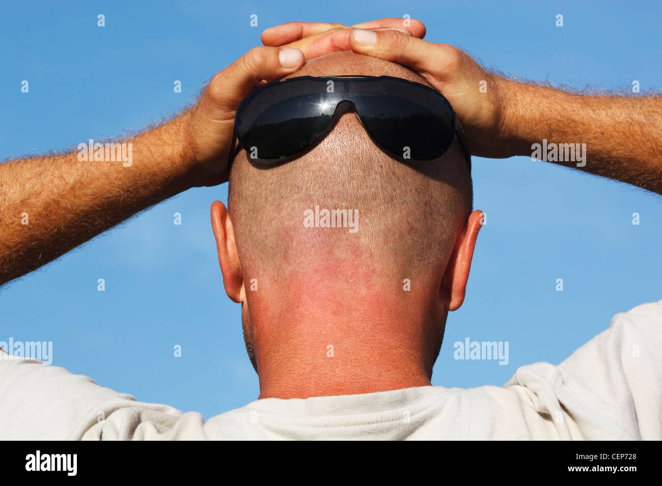 Uomo che indossa gli occhiali da sole sul retro della sua testa rasata e  con le mani appoggiate sulla cima della sua testa; Spagna Foto stock - Alamy