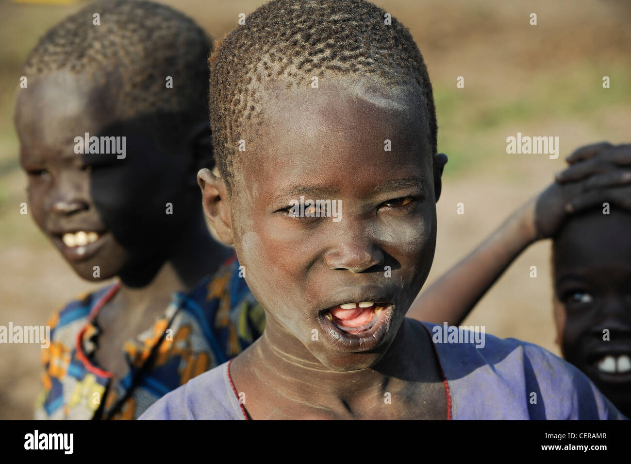 SUDAN MERIDIONALE, Stato dei Laghi, tribù Dinka, campo di bestiame vicino a Rumbek, ragazzo con denti inferiori rotti, parte del culto di inizializzazione dei giovani uomini Dinka Foto Stock