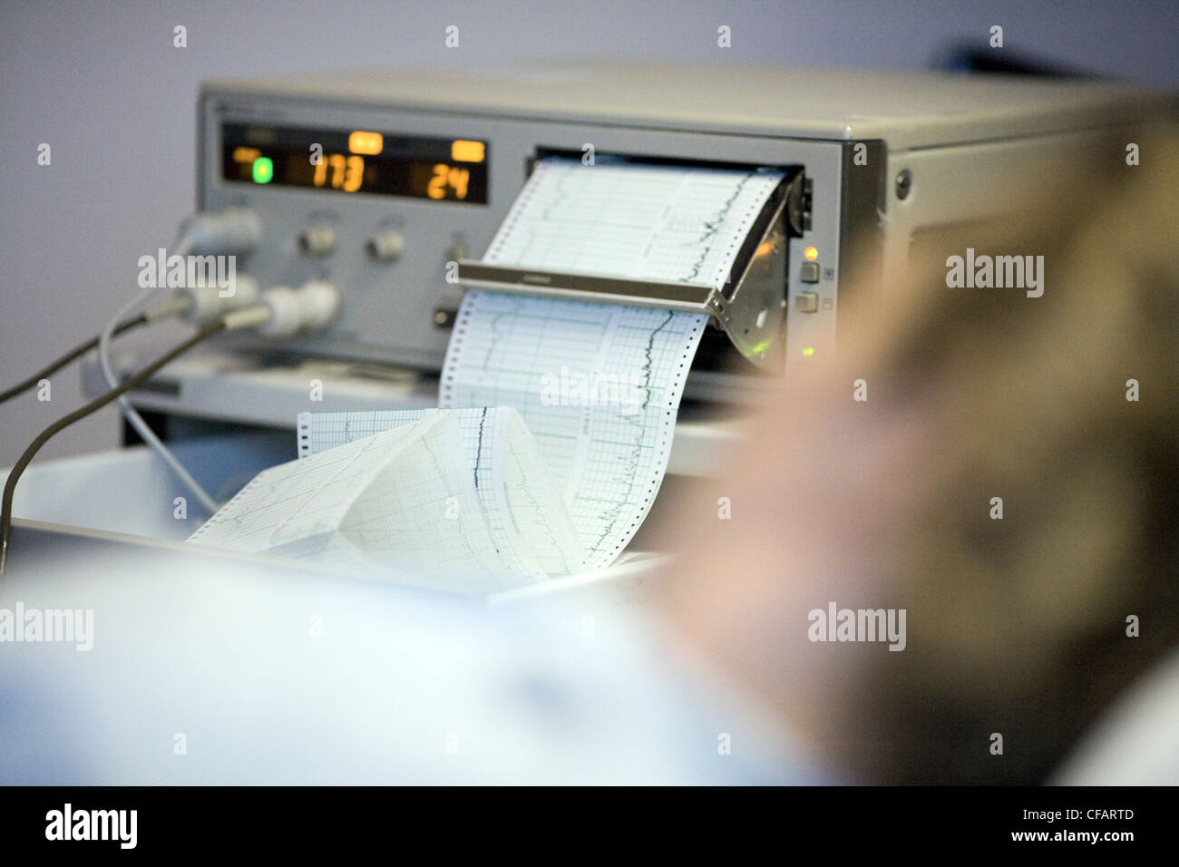 36 anni di donna che sta per partorire con focus su sfondo monitor medicale, Chateauguay, Quebec, Canada Foto Stock
