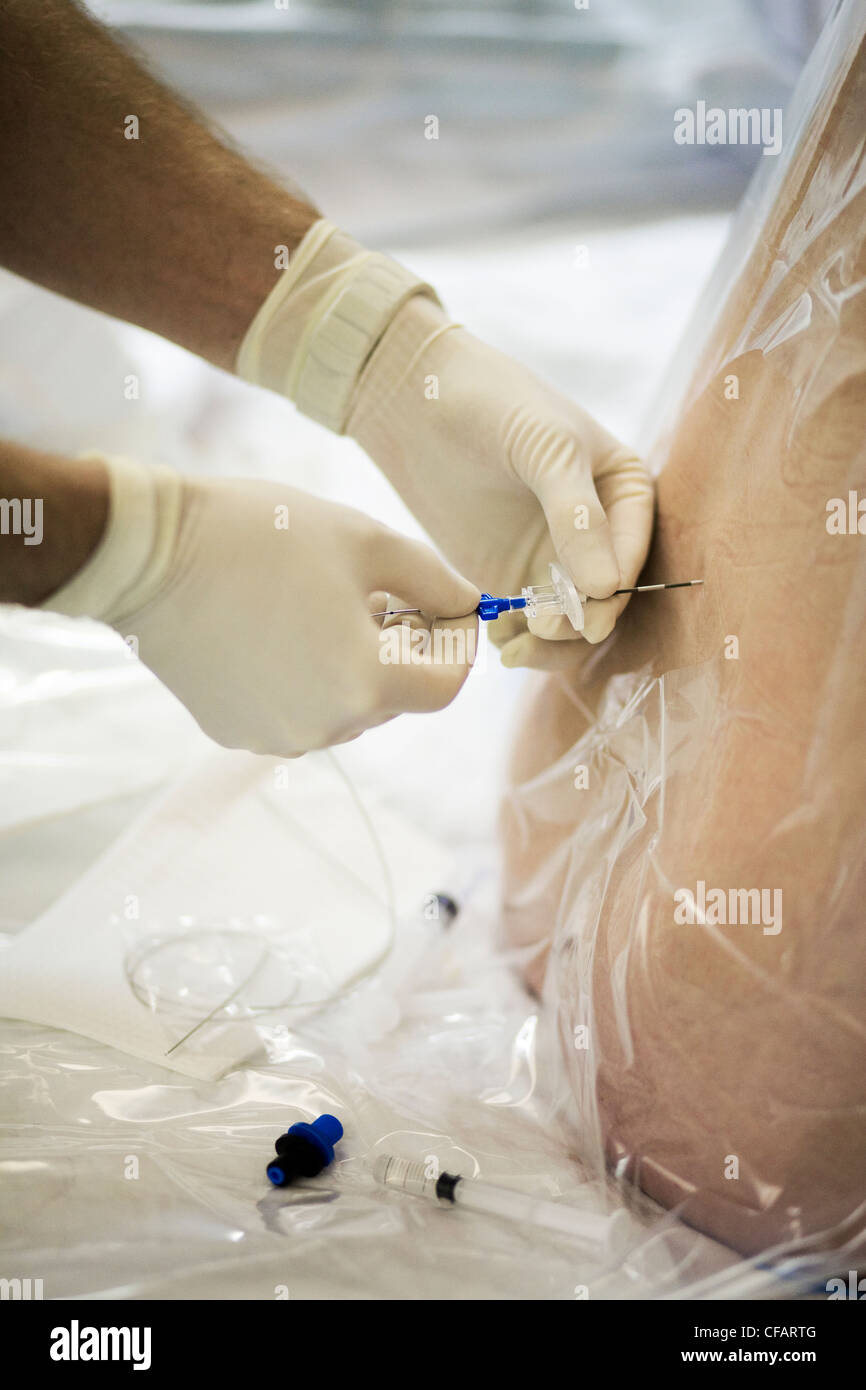 36 anni di donna che sta per partorire ricevendo un epidurale, Chateauguay, Quebec, Canada Foto Stock