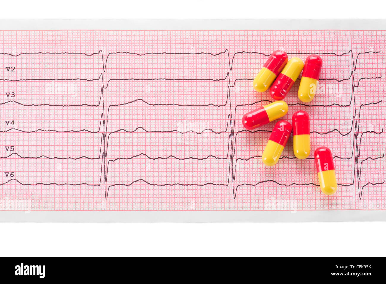 Cardiologia. Macro di grafico ECG e cardio pillole Foto Stock