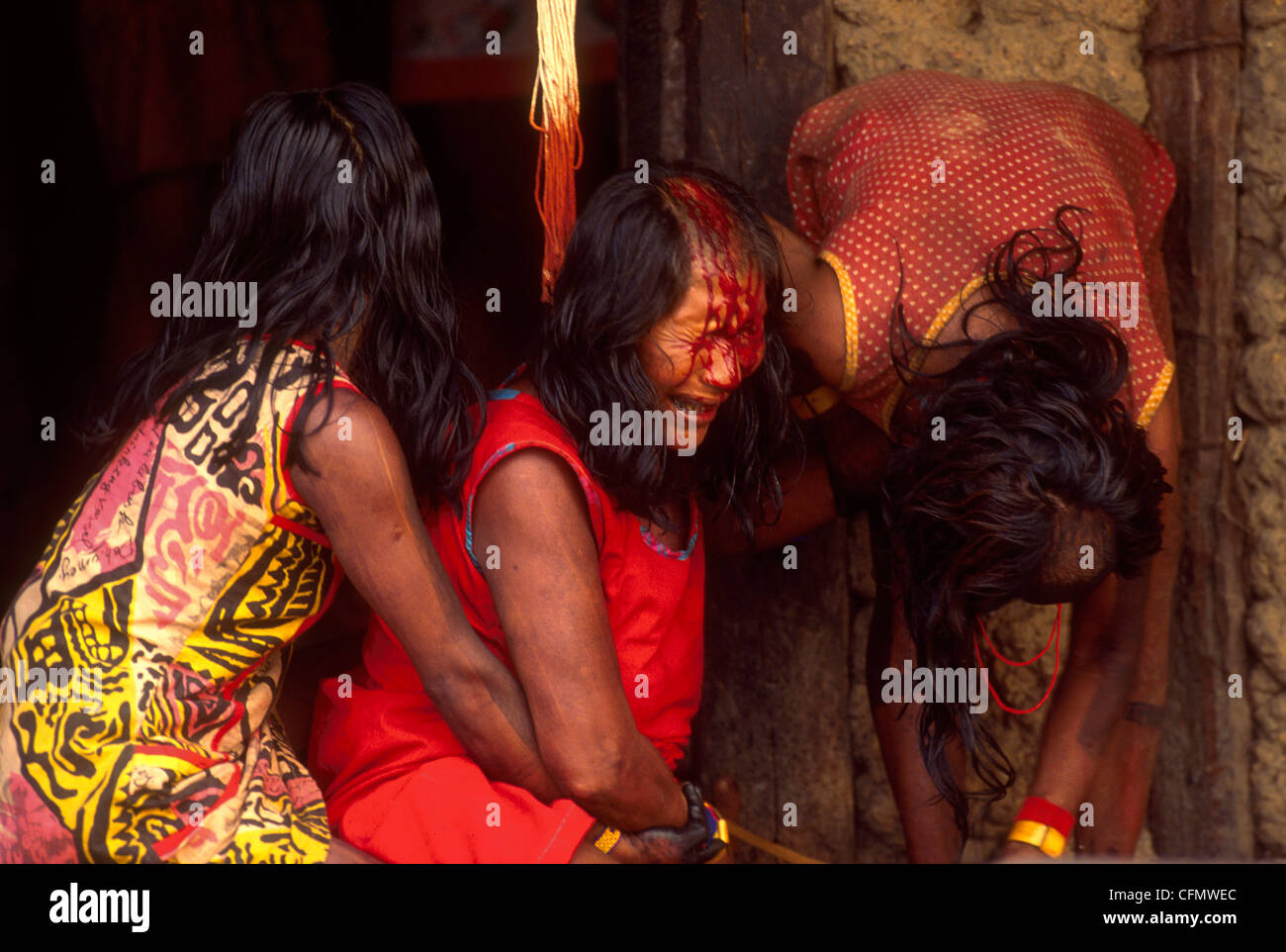 Rito di passaggio quando la Xikrin Indigeni conseguire la maggioranza spirituale della donna ha colpito la propria testa con un machete Amazon Foto Stock