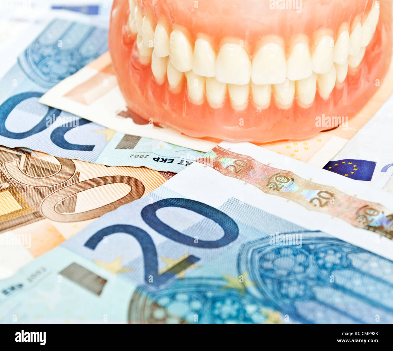 Dentiera in euro - spese dentale concept Foto Stock