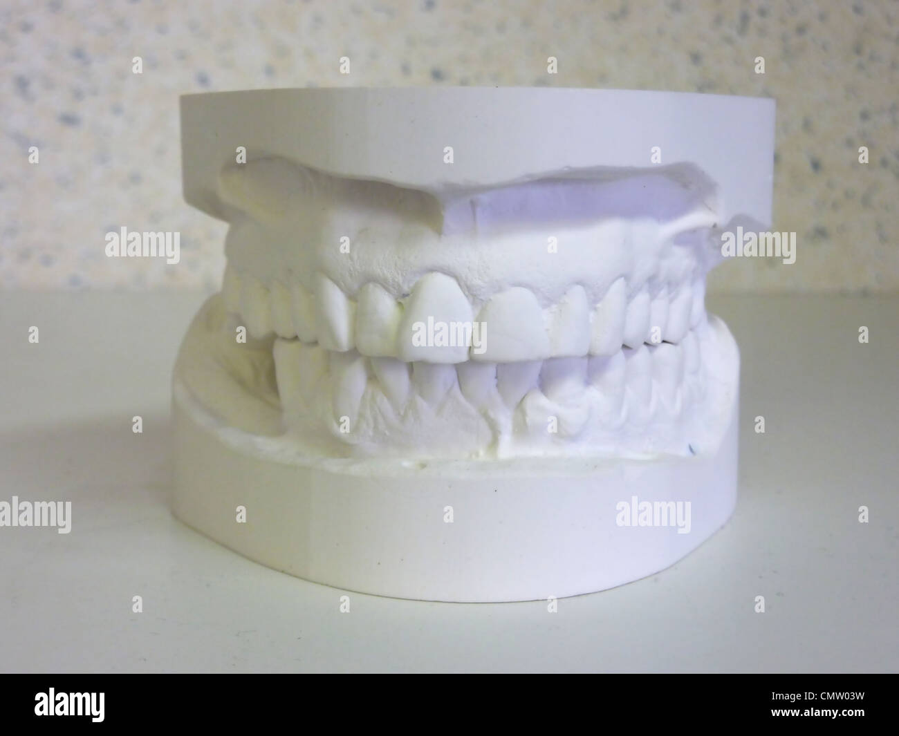 In gesso bianco denti superiori e inferiori immaginando una bocca Foto Stock