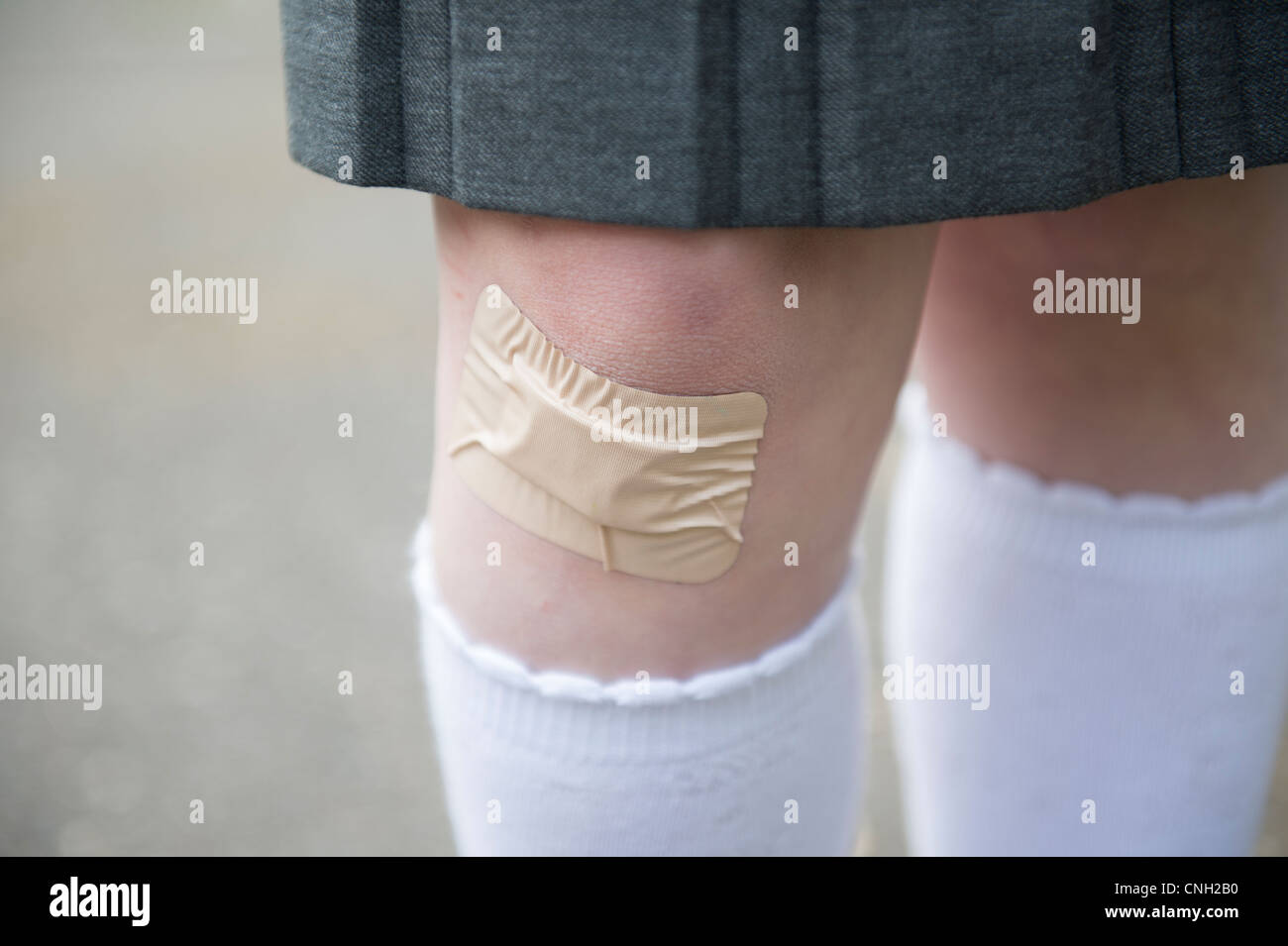 Da studentessa del ginocchio con un cerotto su un taglio. Foto Stock