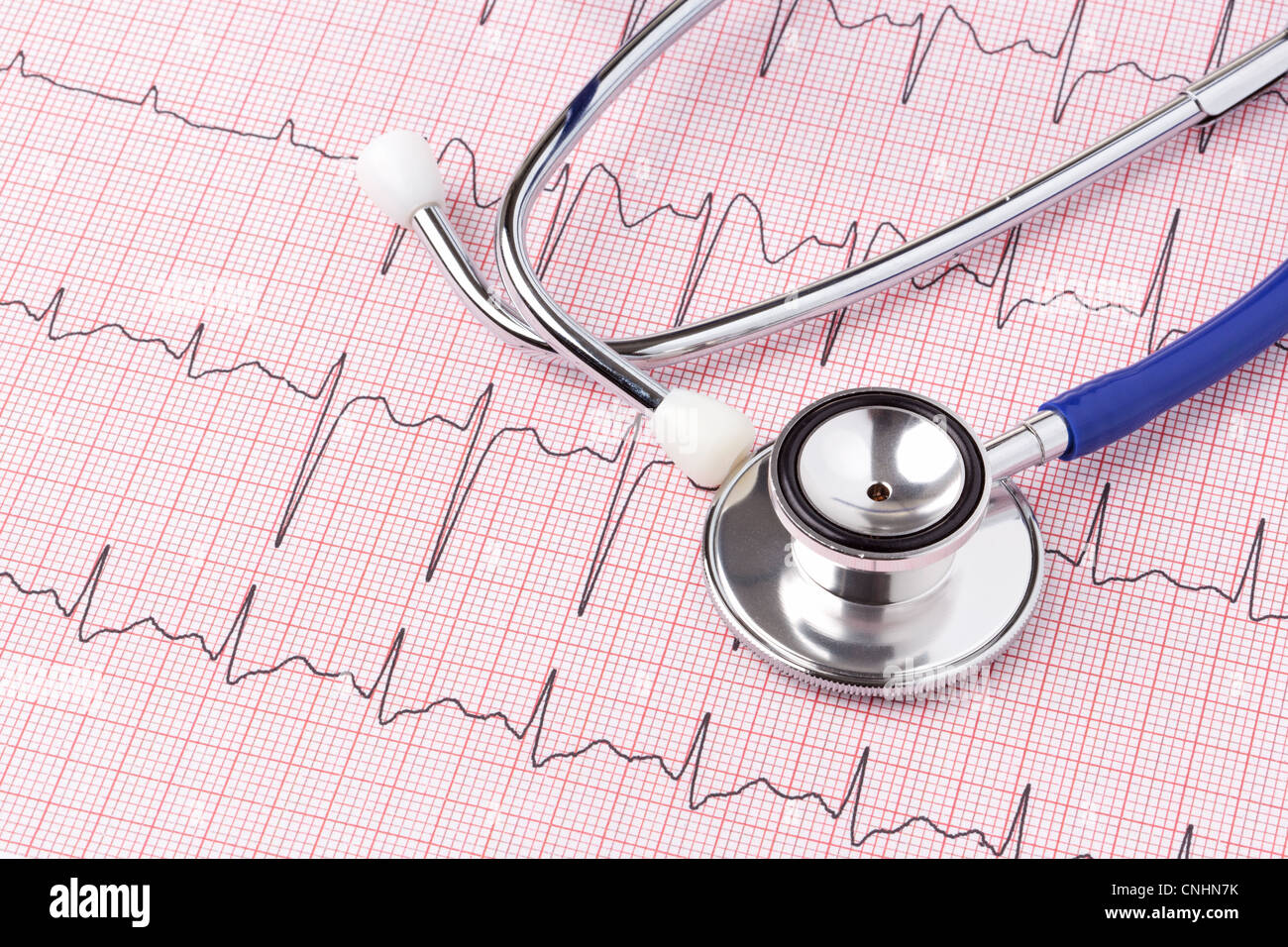 Foto di un elettrocardiogramma ECG o EKG stampa con uno stetoscopio Foto Stock