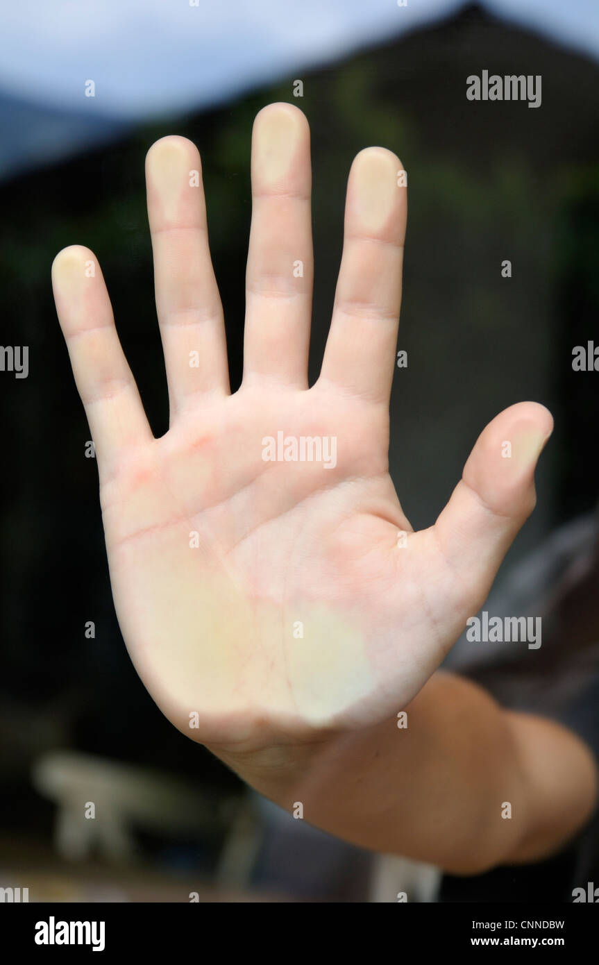 Close-up del palmo della mano, alpi, Francia Foto Stock