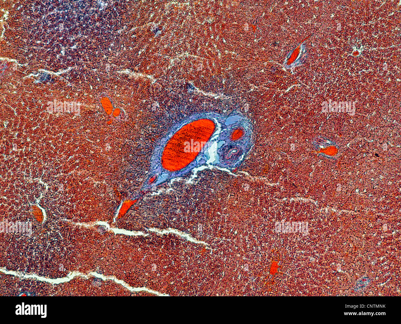 Persone, esseri umani, esseri umani (Homo sapiens sapiens), la sezione trasversale del fegato con storage di glicogeno Foto Stock