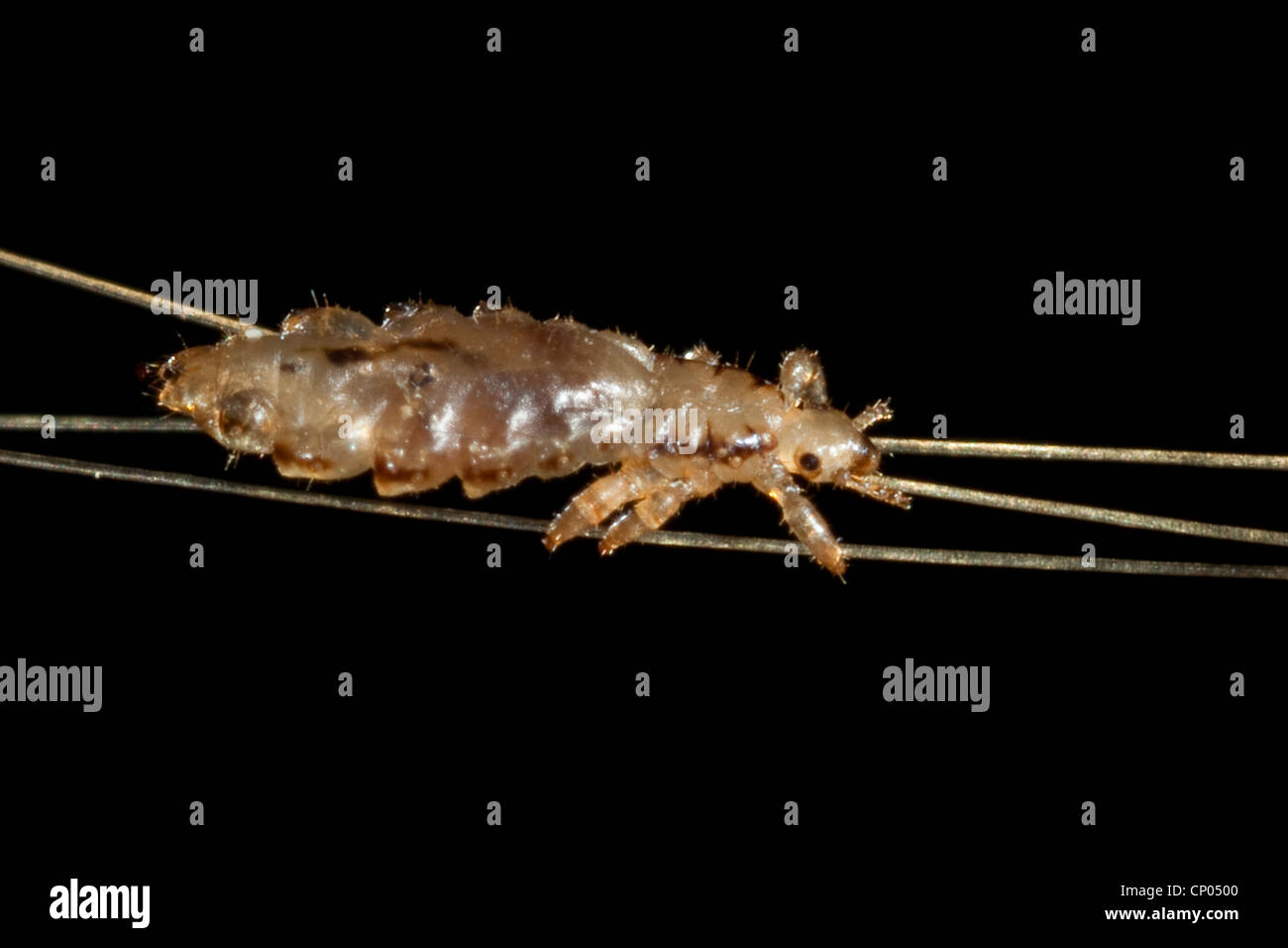 Вши 2024. Вши 2024. Вши 2024. Вши 2024. Вши паразитические насекомые.