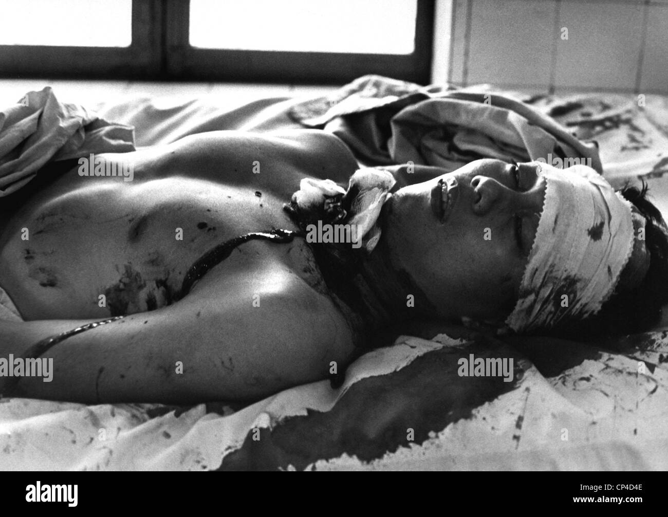 Guerra del Vietnam. Uno di 48 persone ferito da un Viet Cong esplosione che ha ucciso 14 persone a Saigon attende il trattamento in Cong Foto Stock