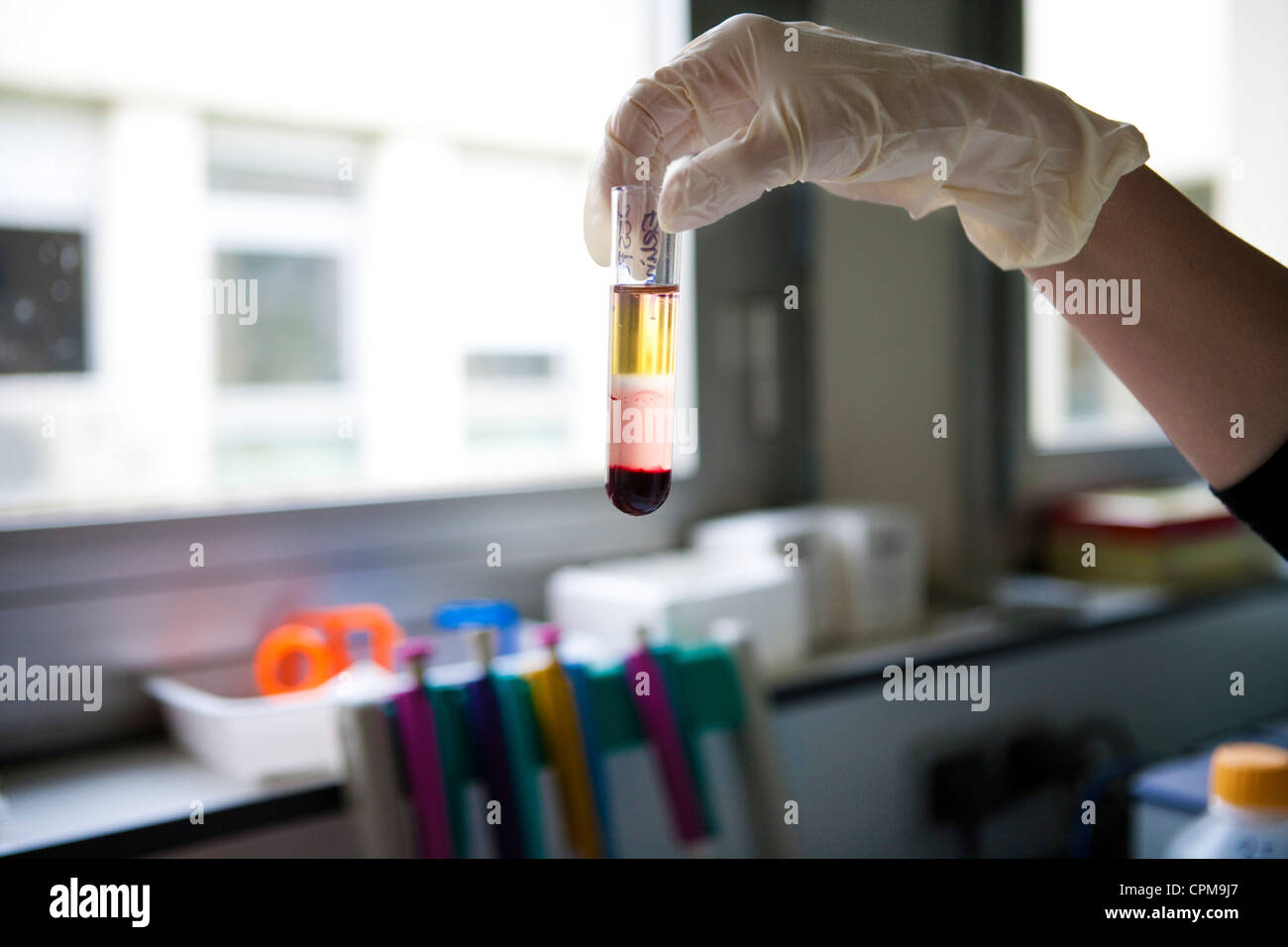 ANALISI DEL SANGUE Foto Stock