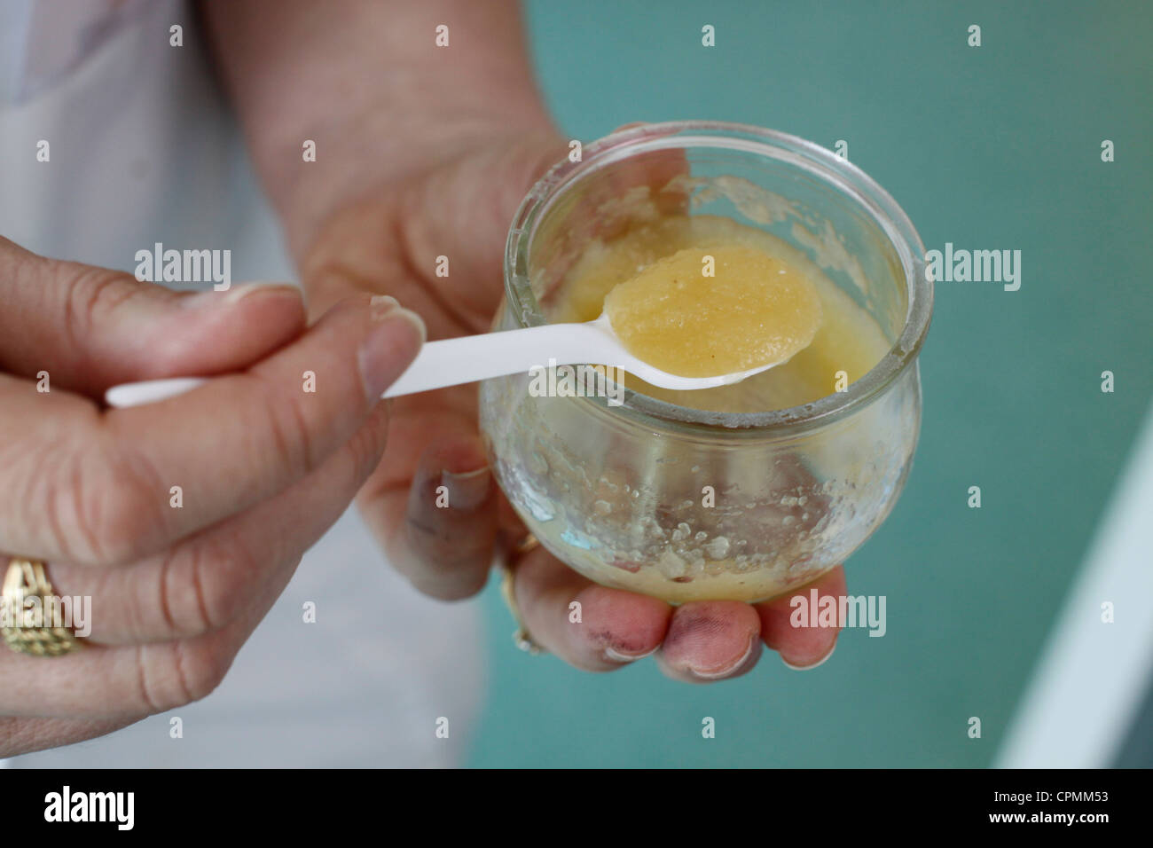 PROVA DI ALLERGIA Foto Stock