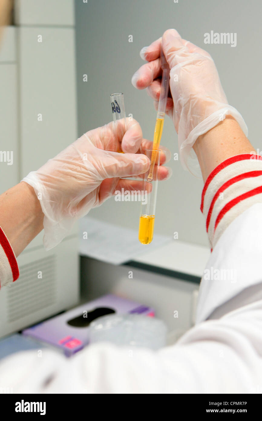 ANALISI DEL SANGUE Foto Stock