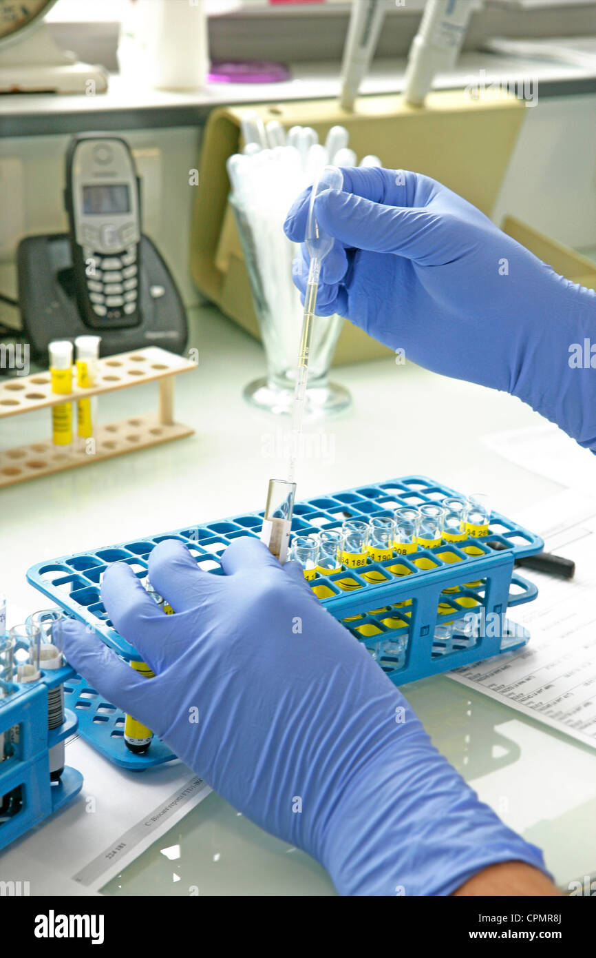 ANALISI DEL SANGUE Foto Stock