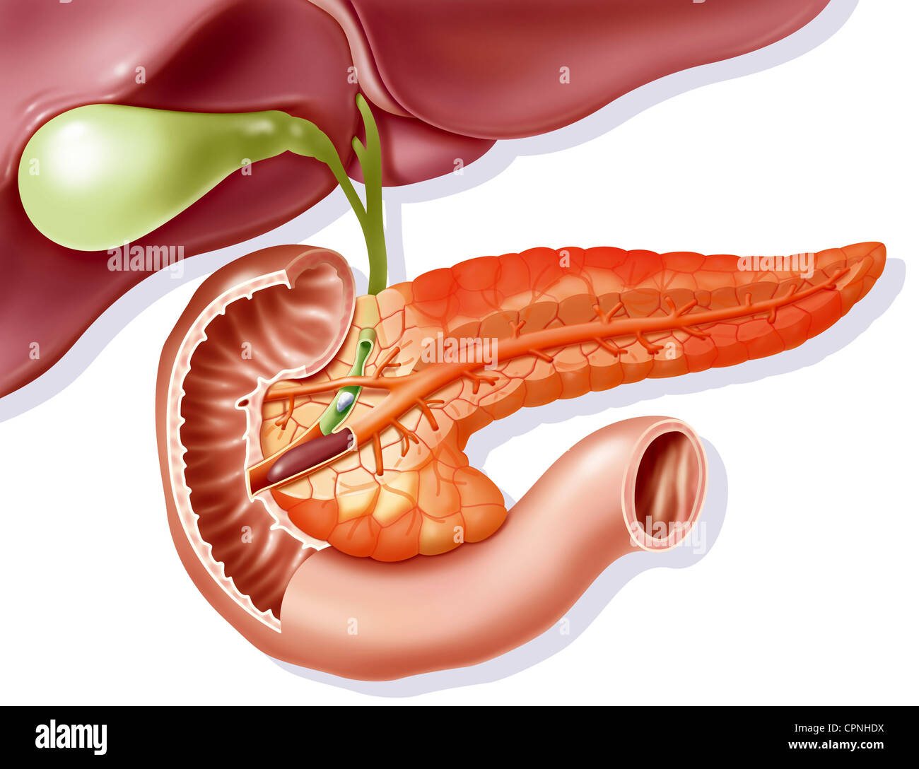 La pancreatite acuta, anatomia Foto Stock