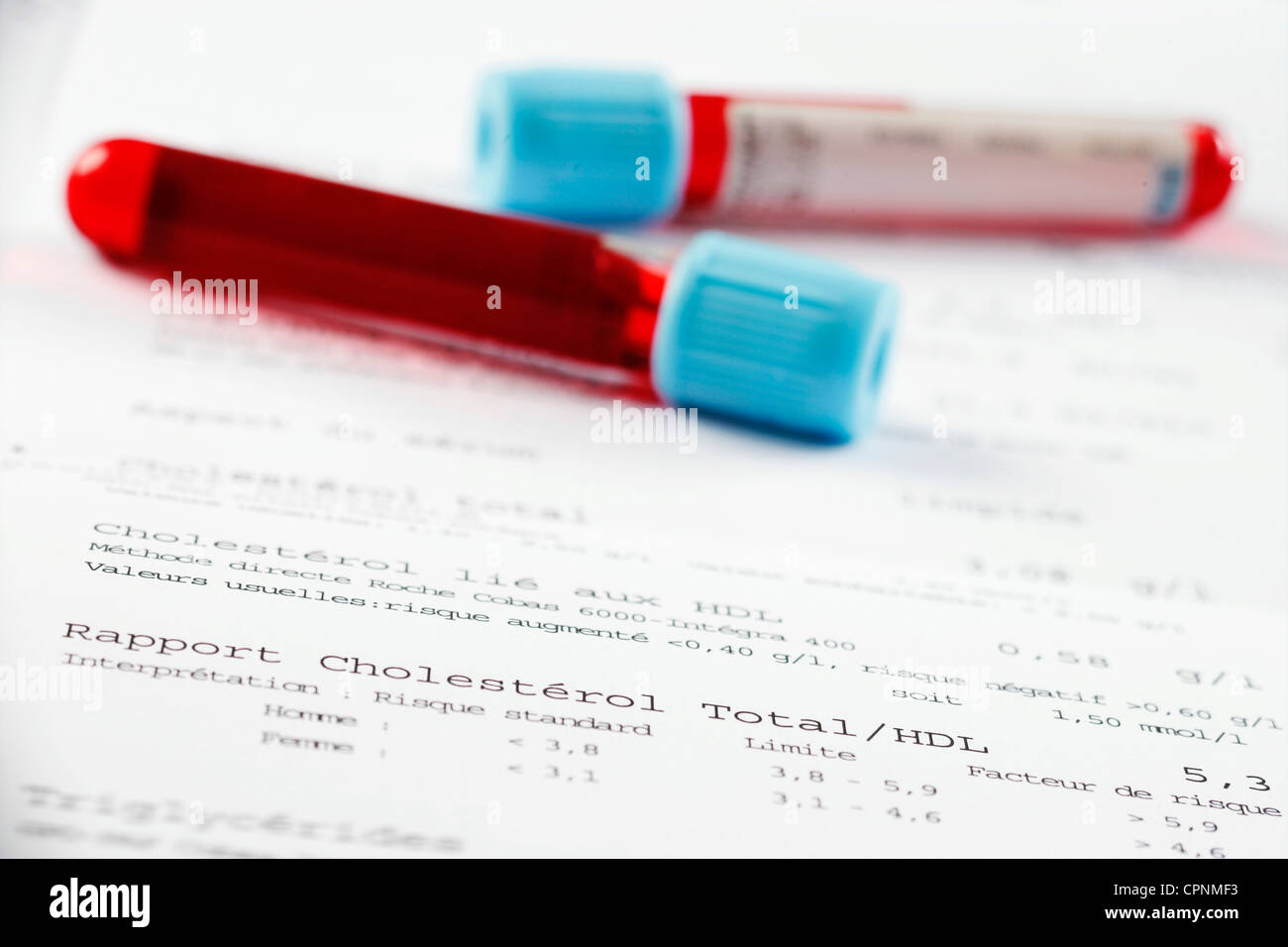 Il sangue risultato analisi Foto Stock