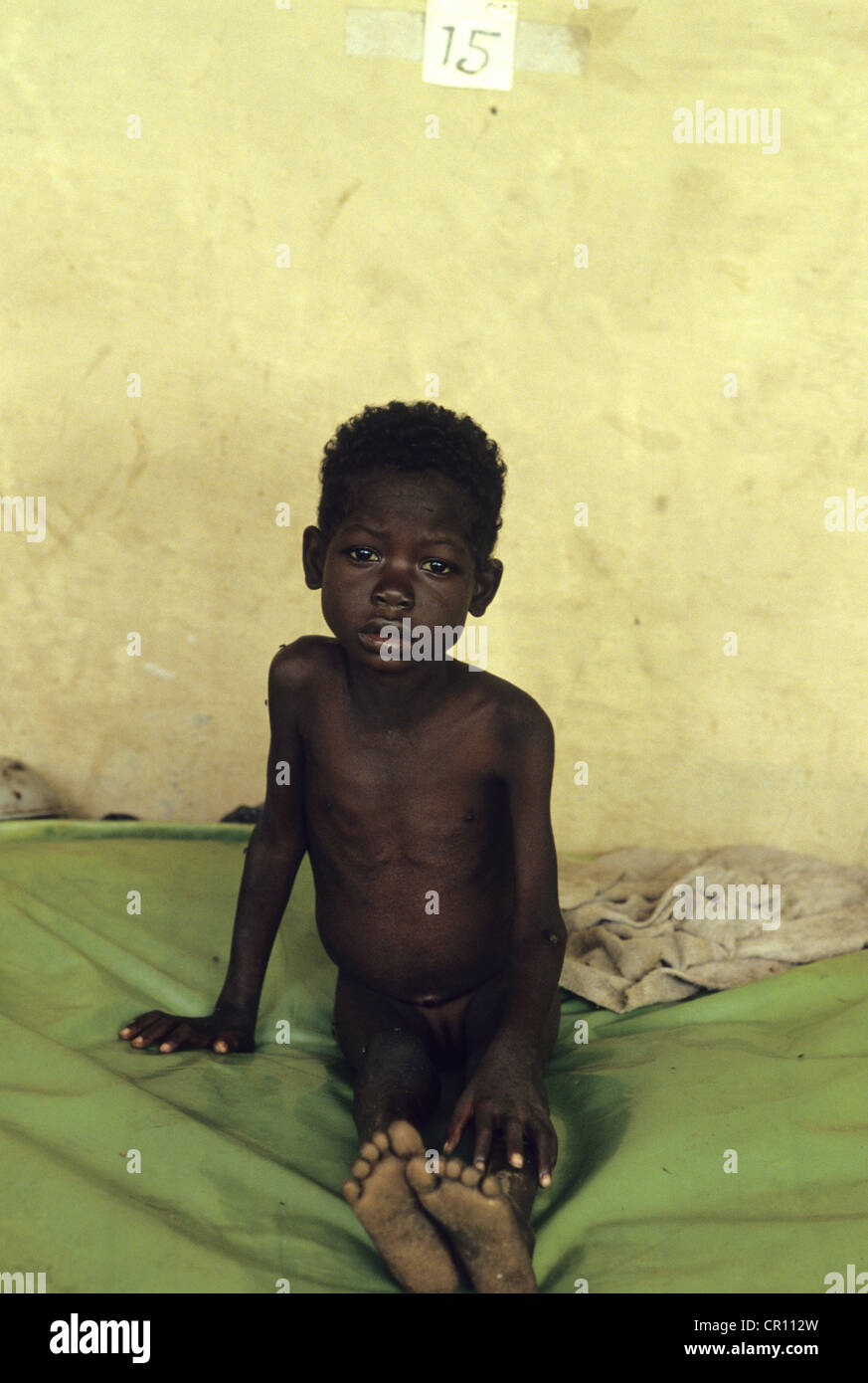 Un Dinka ragazza in un ospedale di fortuna a Thiet alimentazione di camp in Sudan meridionale. Foto Stock