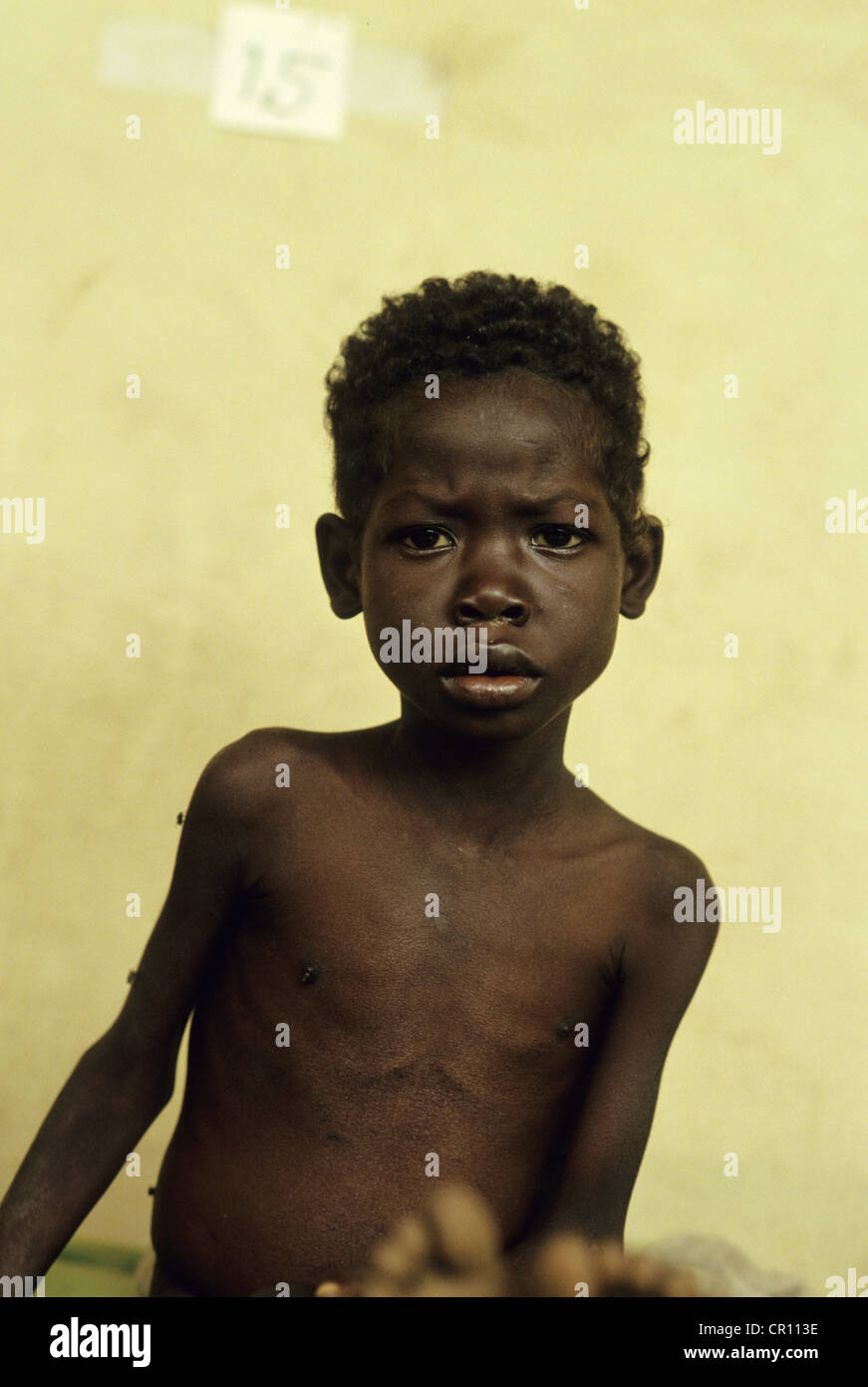 Un Dinka grill in un ospedale di fortuna a Thiet alimentazione di camp in Sudan meridionale. Foto Stock