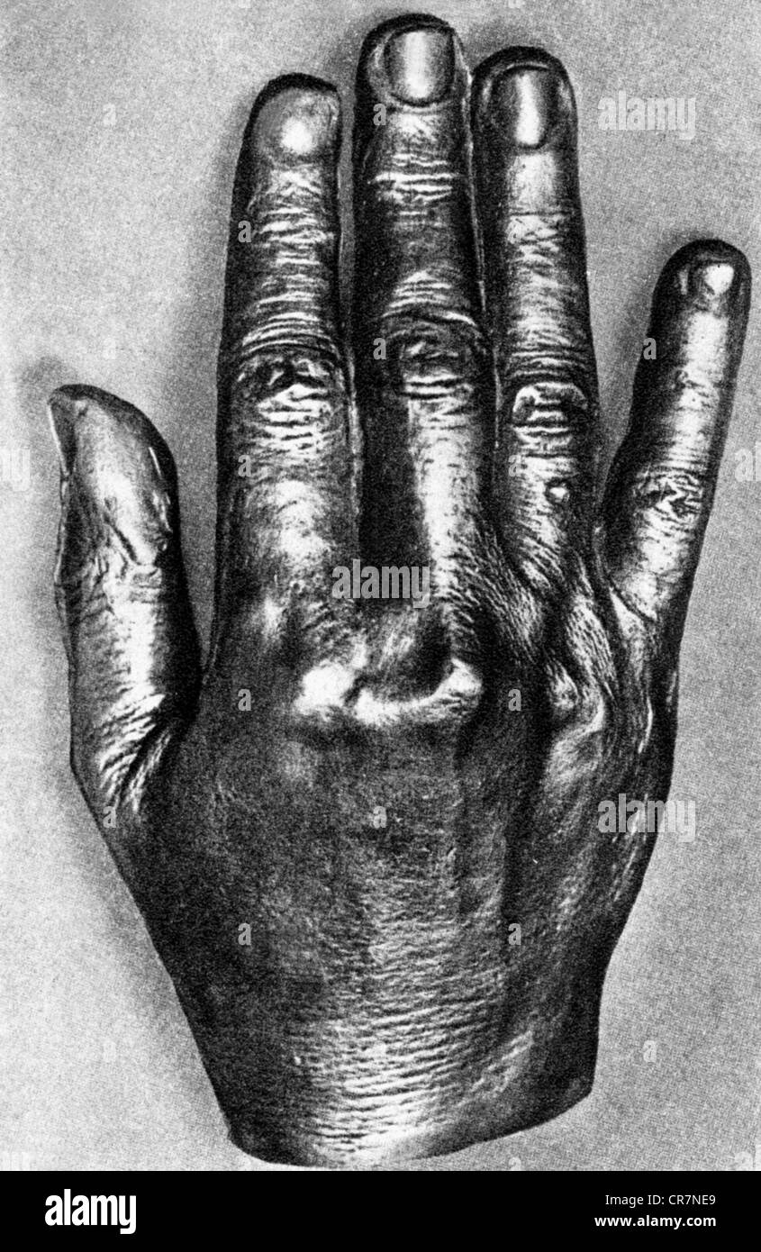 Wagner, Richard, 22.5.1813 - 13.2.1883, compositore tedesco, bronzo di sua destra, museo Richard Wagner, Eisenach, Foto Stock