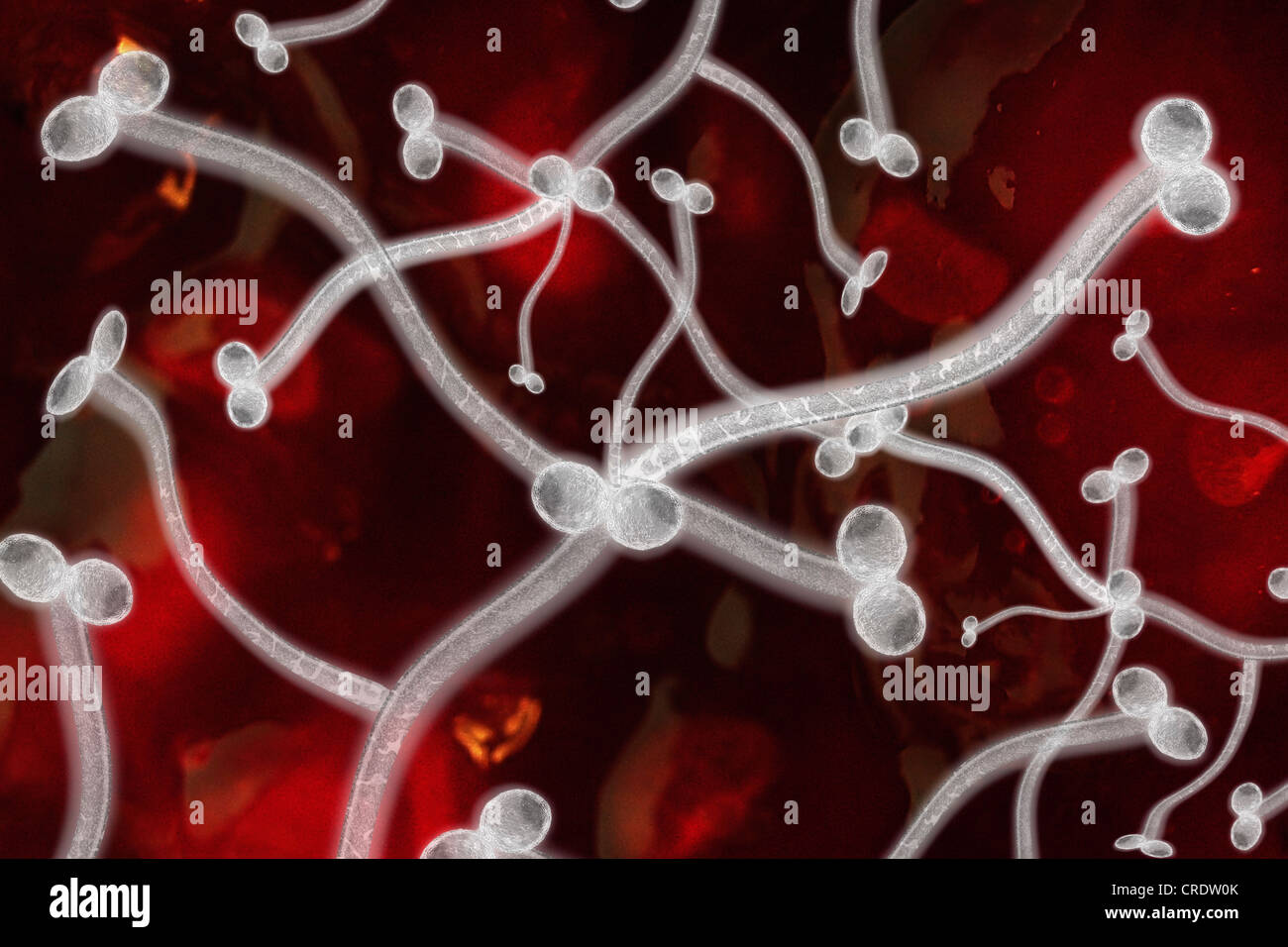 Le cellule di lievito, Soorpilz come agenti patogeni, illustrazione Foto Stock