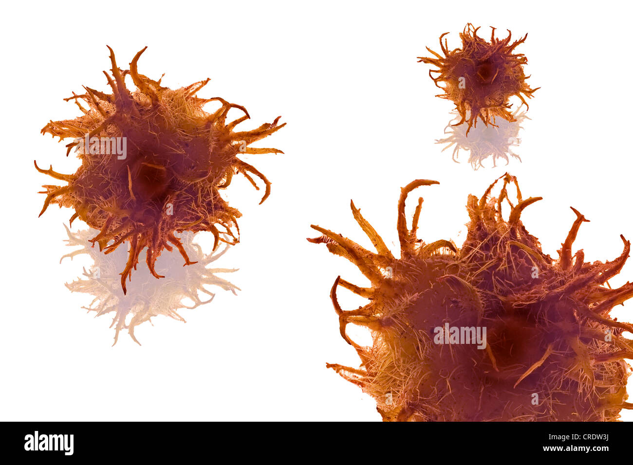 Il tumore in una fase precoce, illustrazione Foto Stock