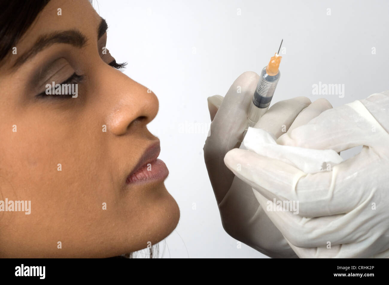 Un chirurgo preparando per iniettare il collagene in una donna di labbro superiore. Foto Stock