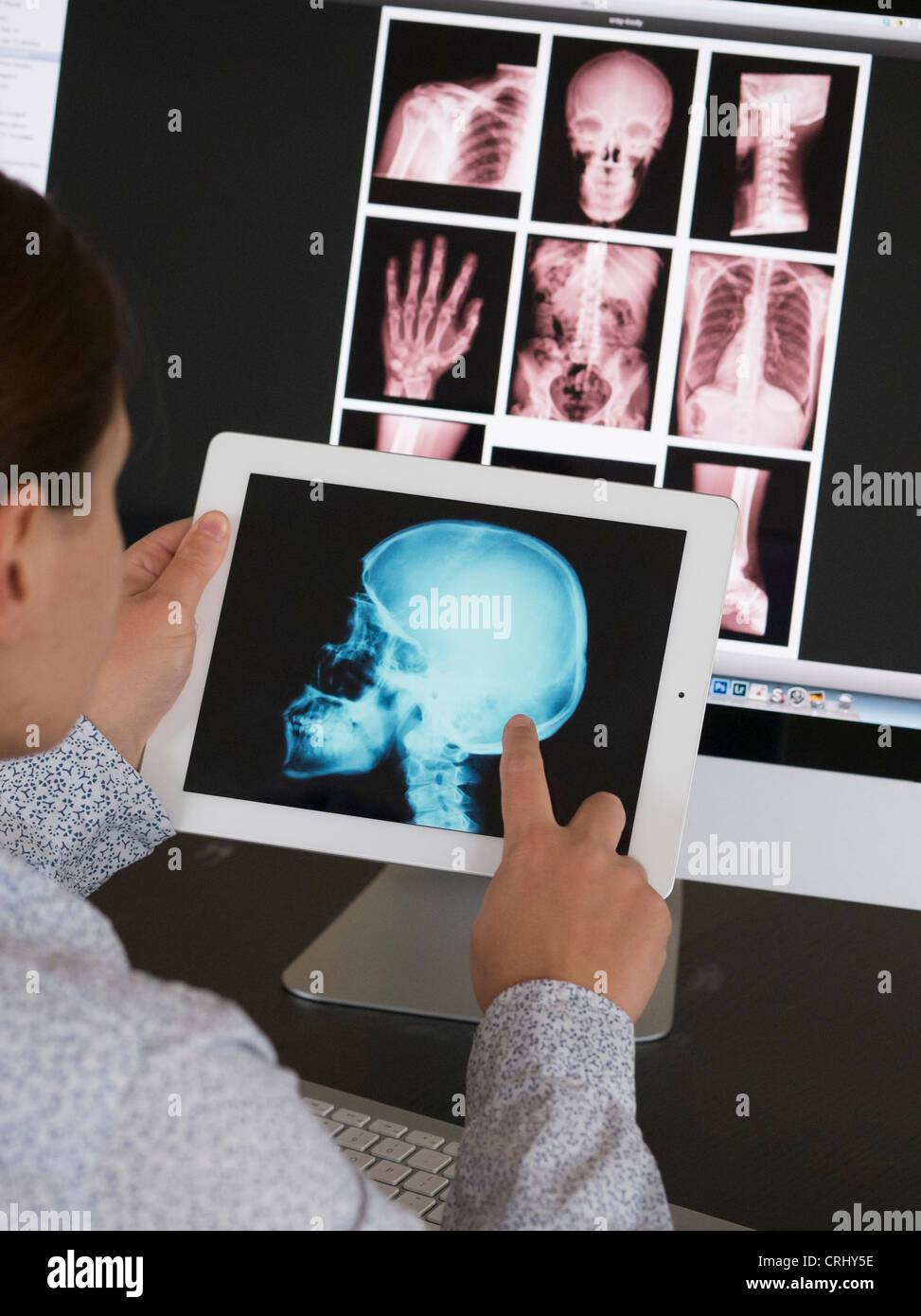 Medico usando le app iPad per visualizzare le immagini a raggi x del paziente Foto Stock