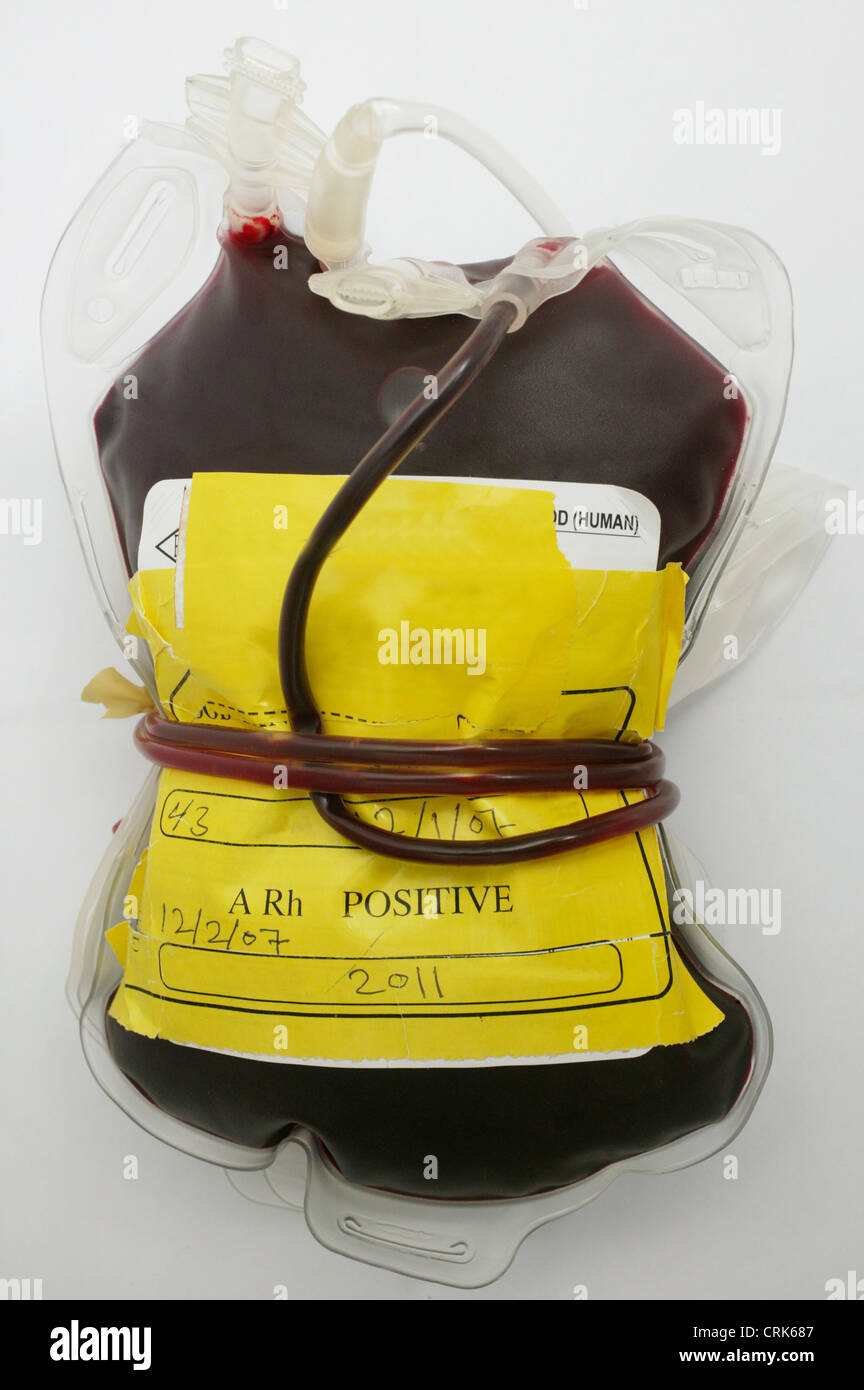 A+ tipo di sacca di sangue Foto Stock